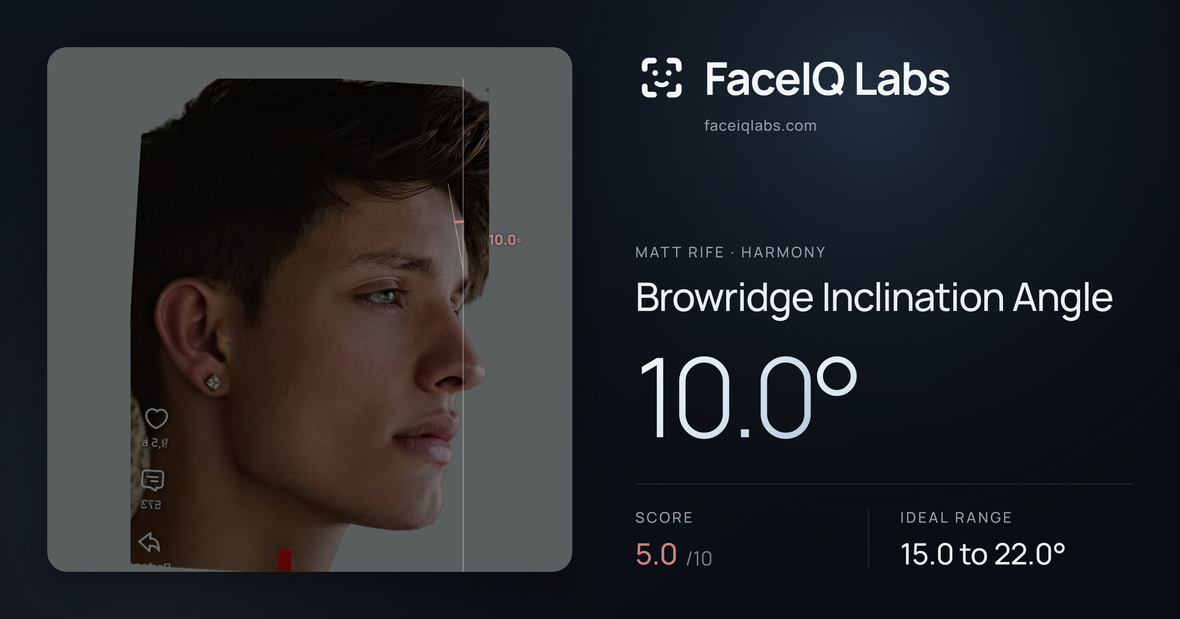 Matt Rife Browridge Inclination Angle: 10.0°, drawn on the photo