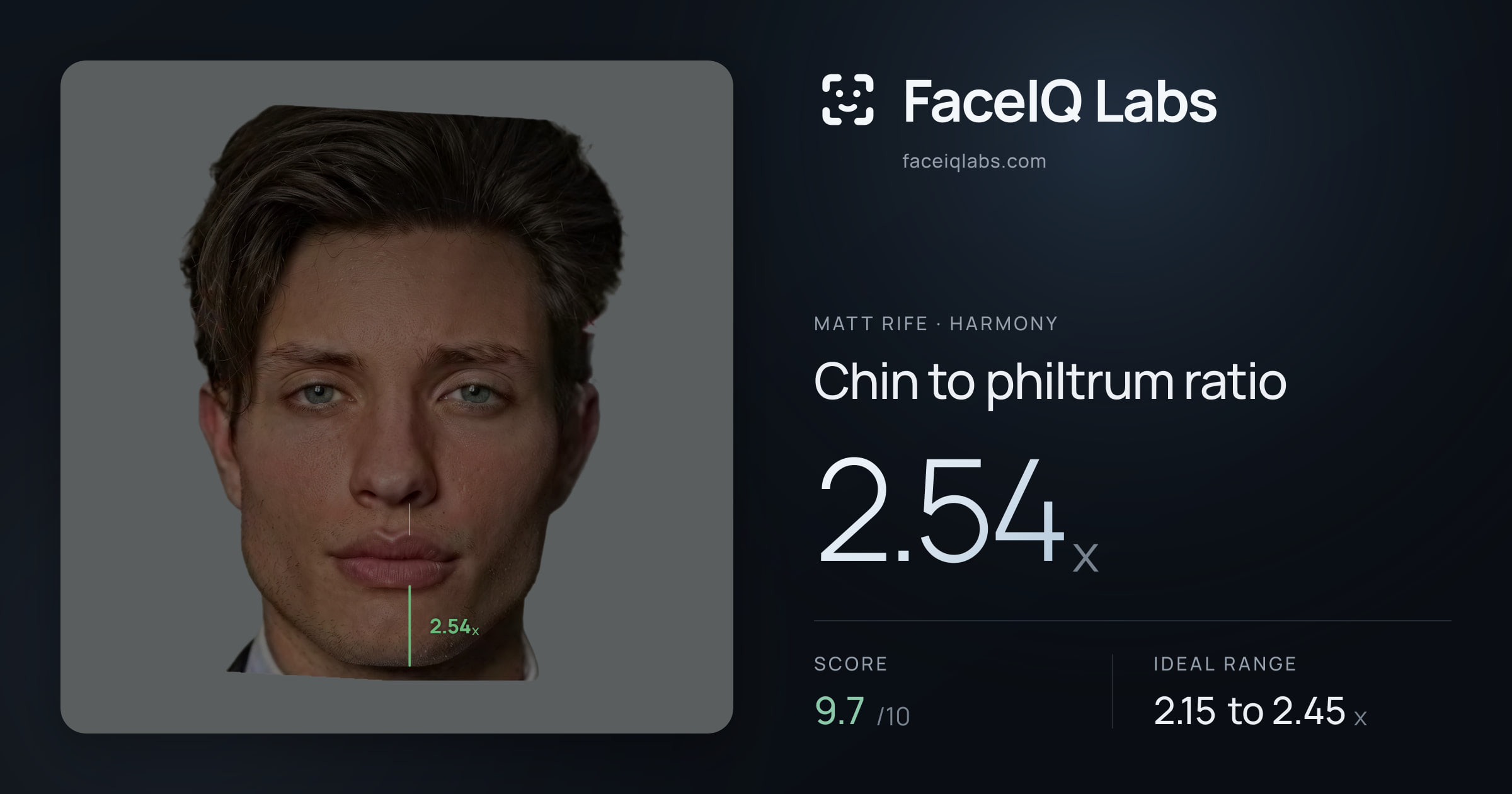 Matt Rife Chin to philtrum ratio: 2.54x, drawn on the photo