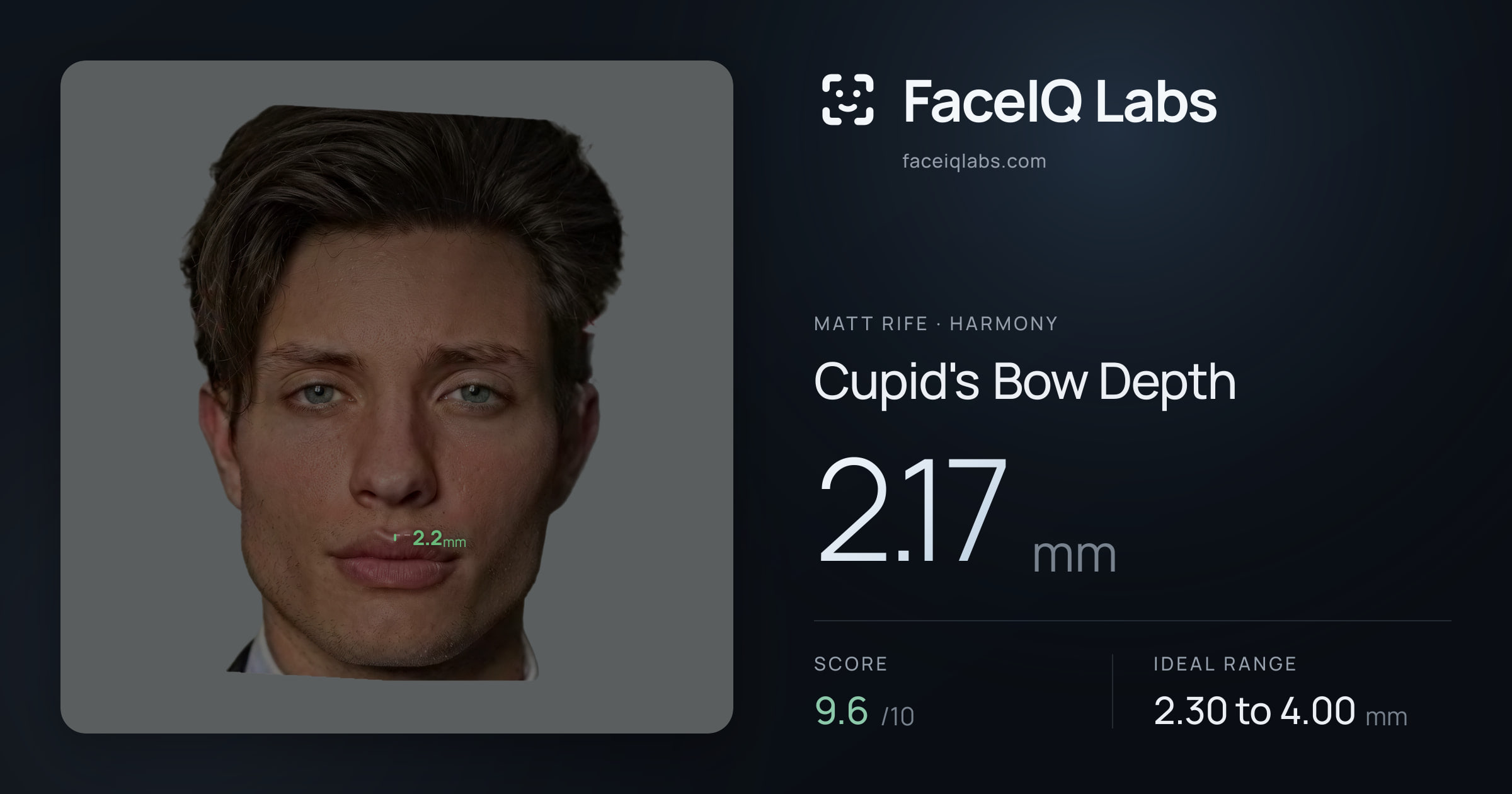 Matt Rife Cupid's Bow Depth: 2.17mm, drawn on the photo