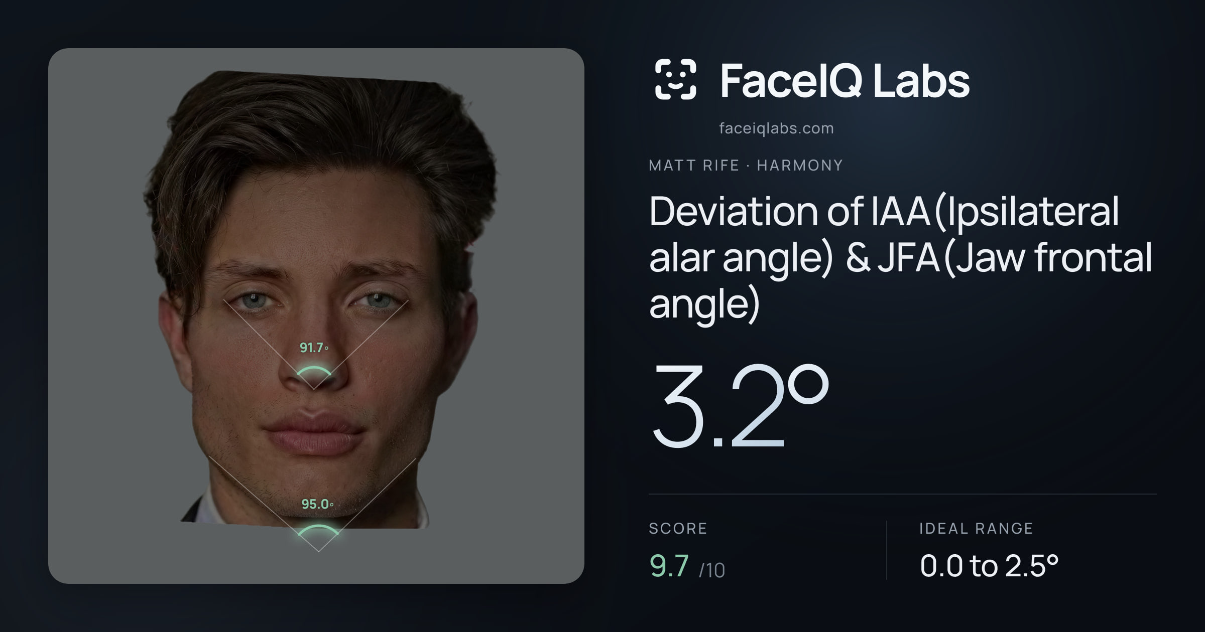 Matt Rife Deviation of IAA(Ipsilateral alar angle) & JFA(Jaw frontal angle): 3.2°, drawn on the photo