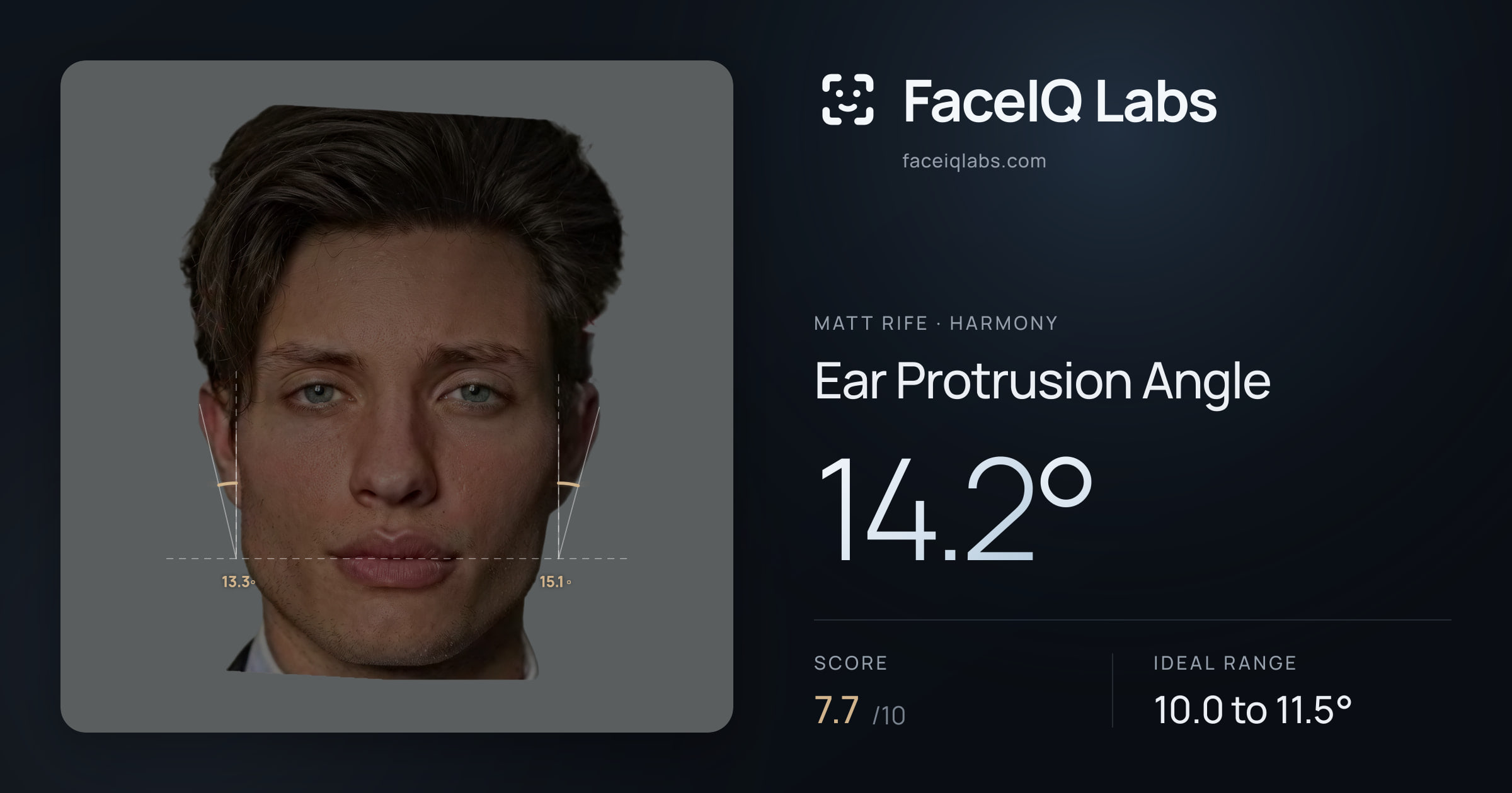 Matt Rife Ear Protrusion Angle: 14.2°, drawn on the photo