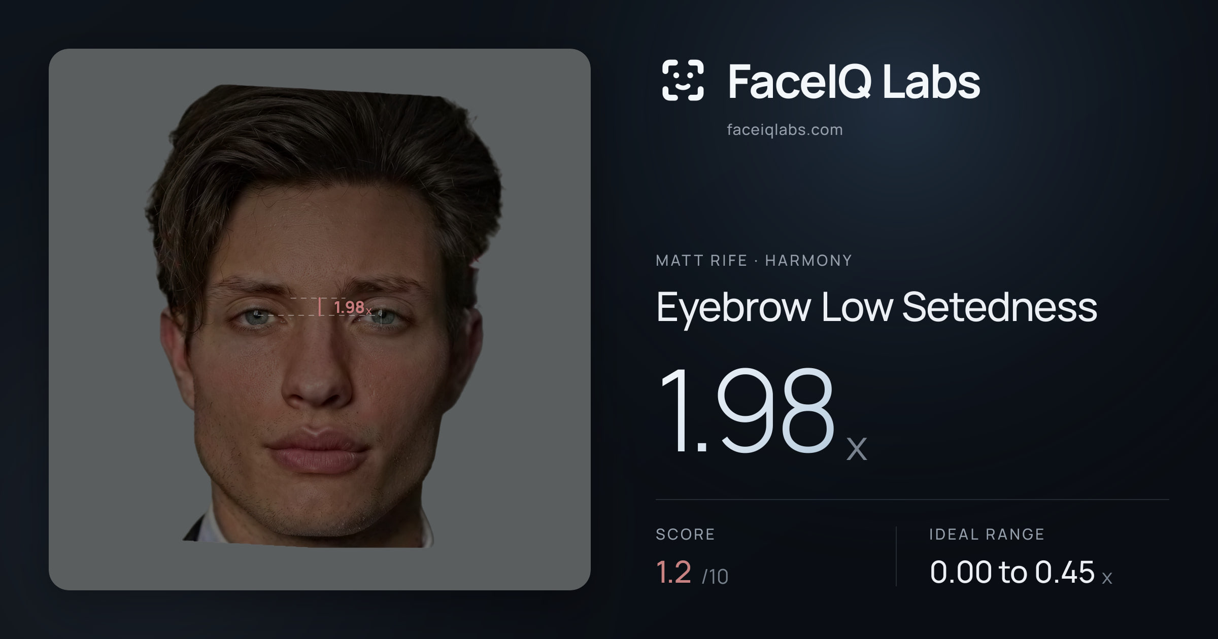 Matt Rife Eyebrow Low Setedness: 1.98x, drawn on the photo
