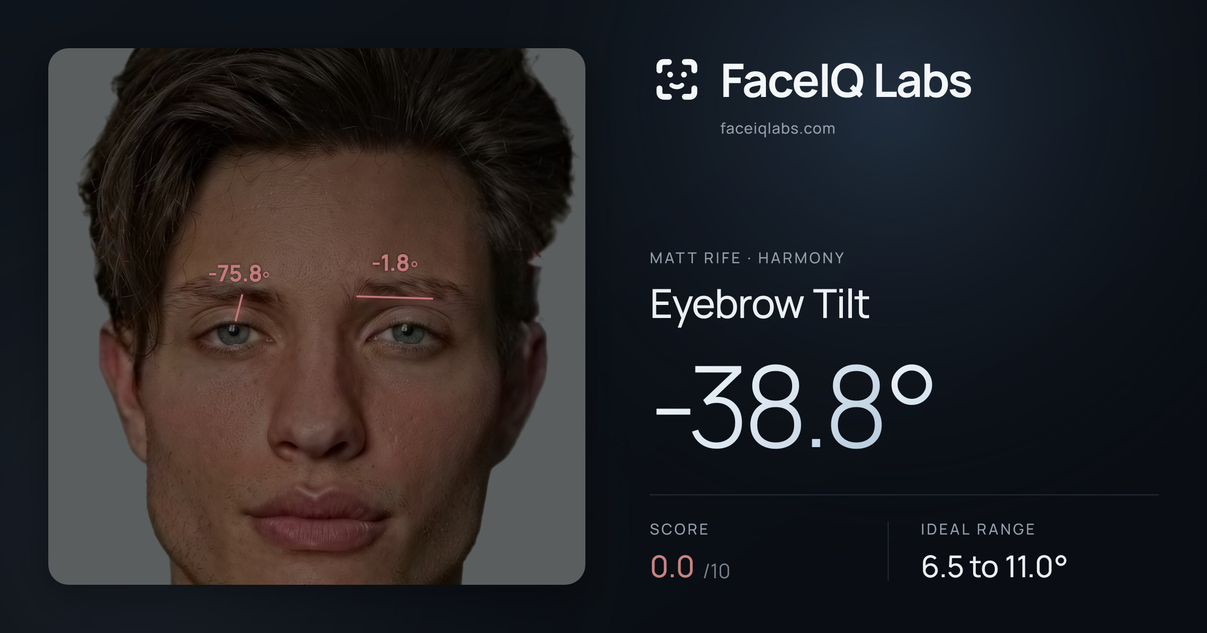 Matt Rife Eyebrow Tilt: -38.8°, drawn on the photo