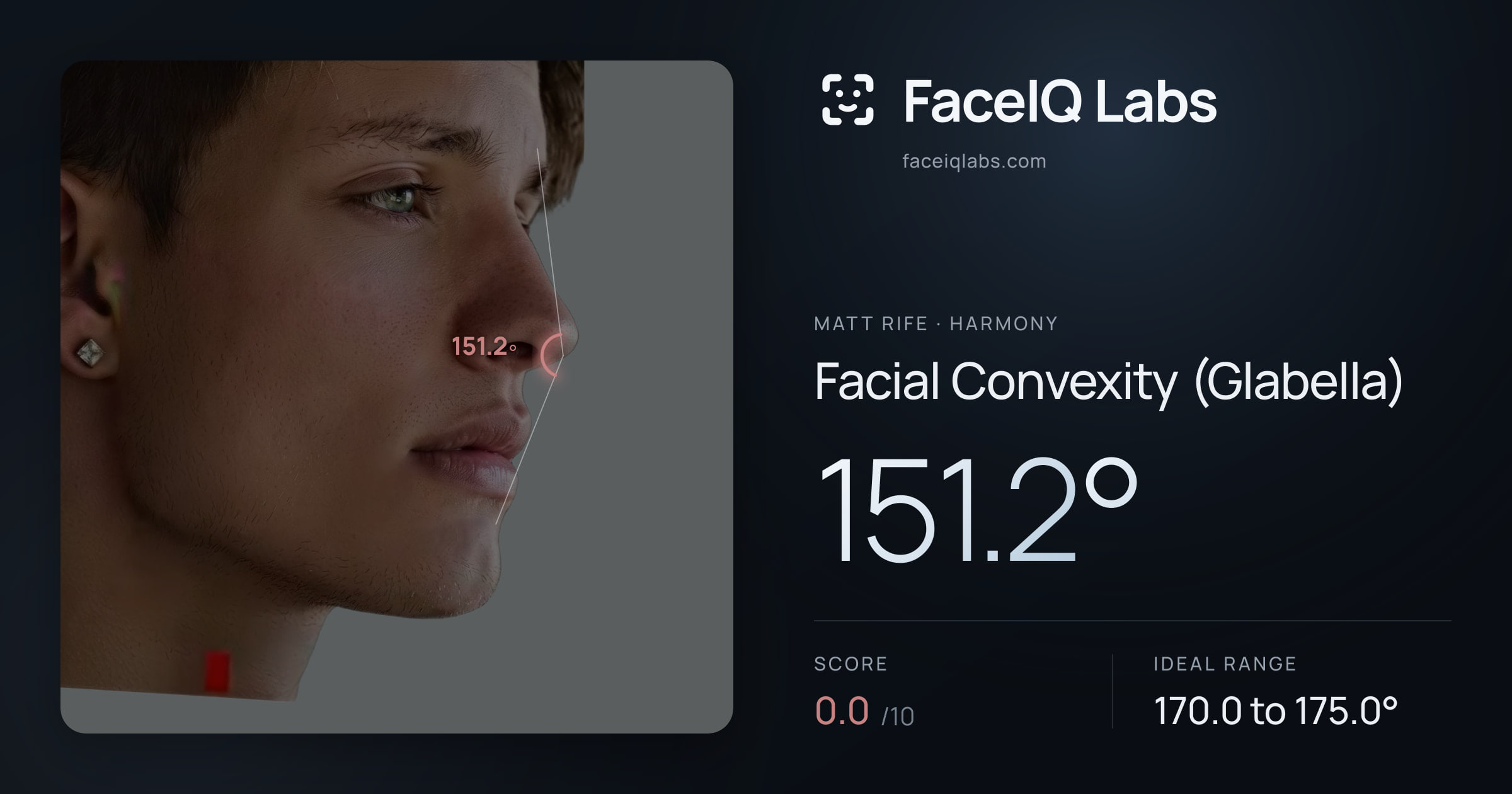Matt Rife Facial Convexity (Glabella): 151.2°, drawn on the photo