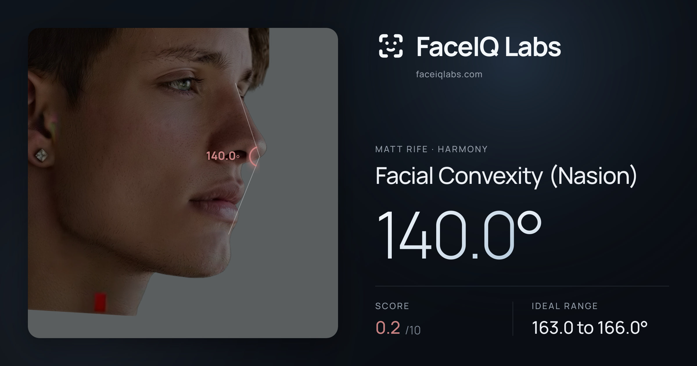 Matt Rife Facial Convexity (Nasion): 140.0°, drawn on the photo