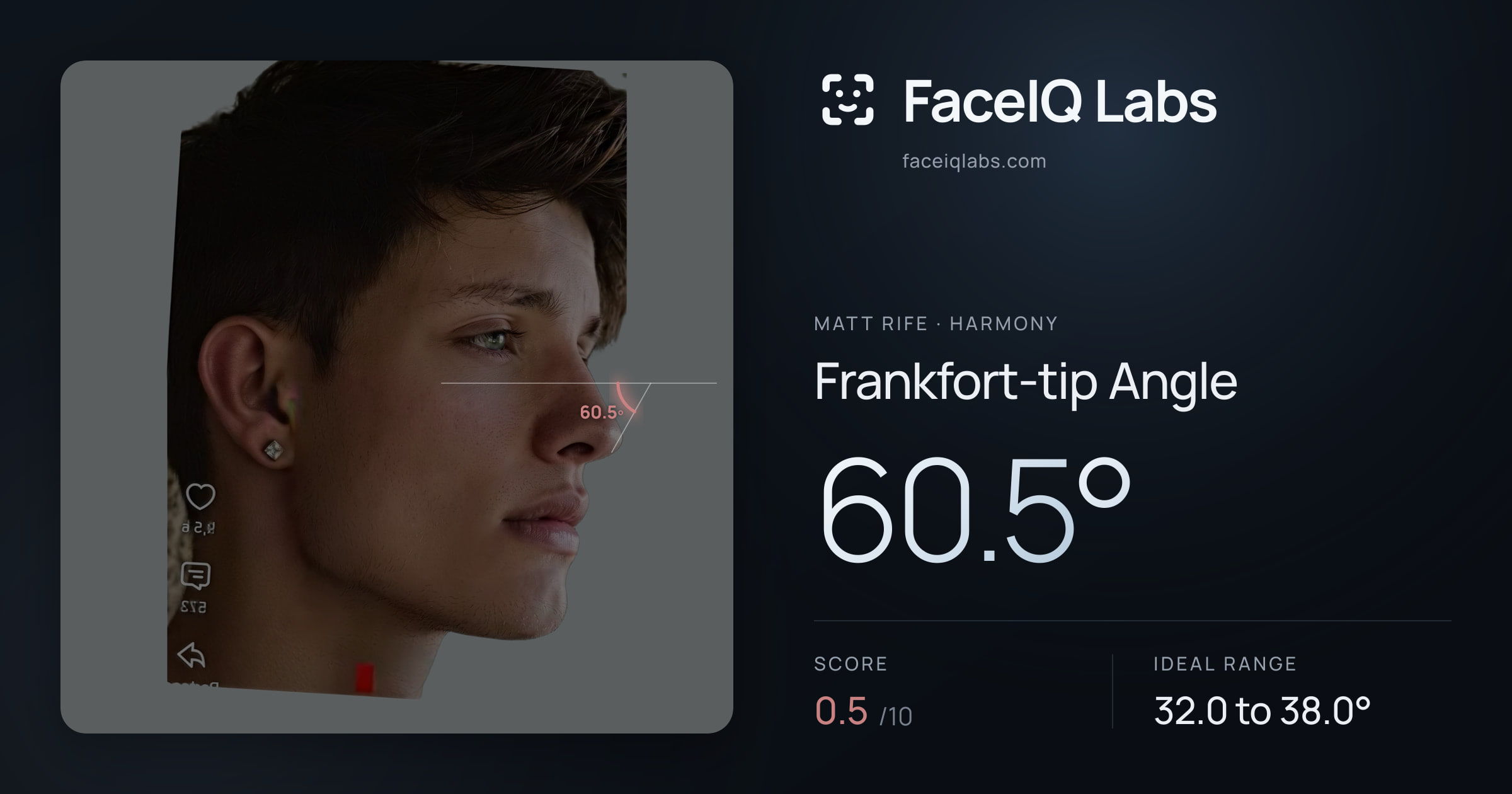 Matt Rife Frankfort-tip Angle: 60.5°, drawn on the photo