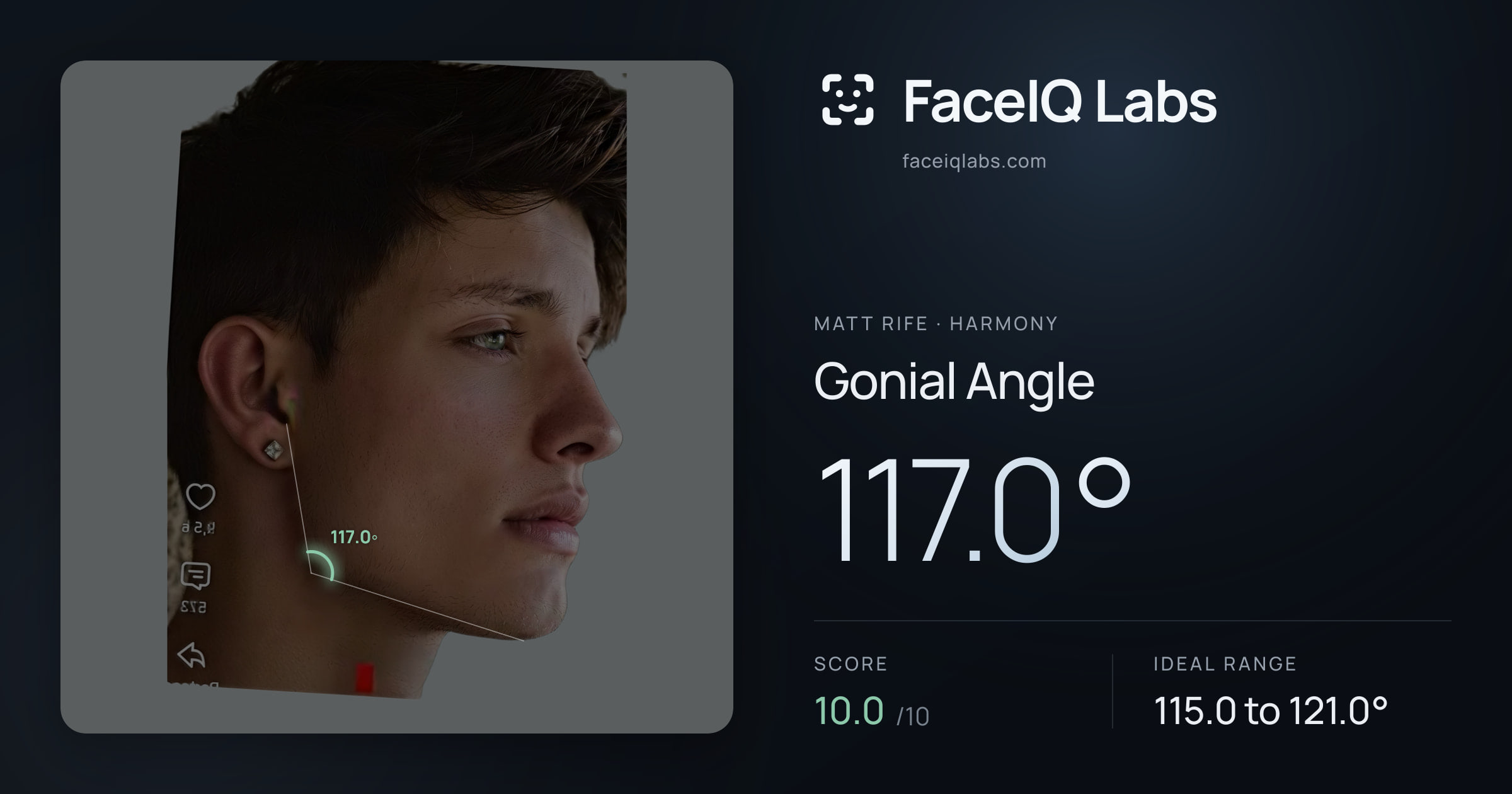 Matt Rife Gonial Angle: 117.0°, drawn on the photo