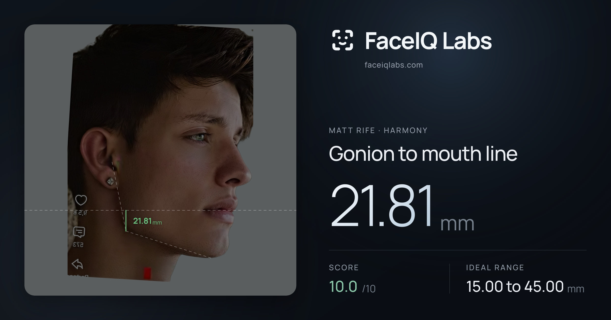 Matt Rife Gonion to mouth line: 21.81mm, drawn on the photo