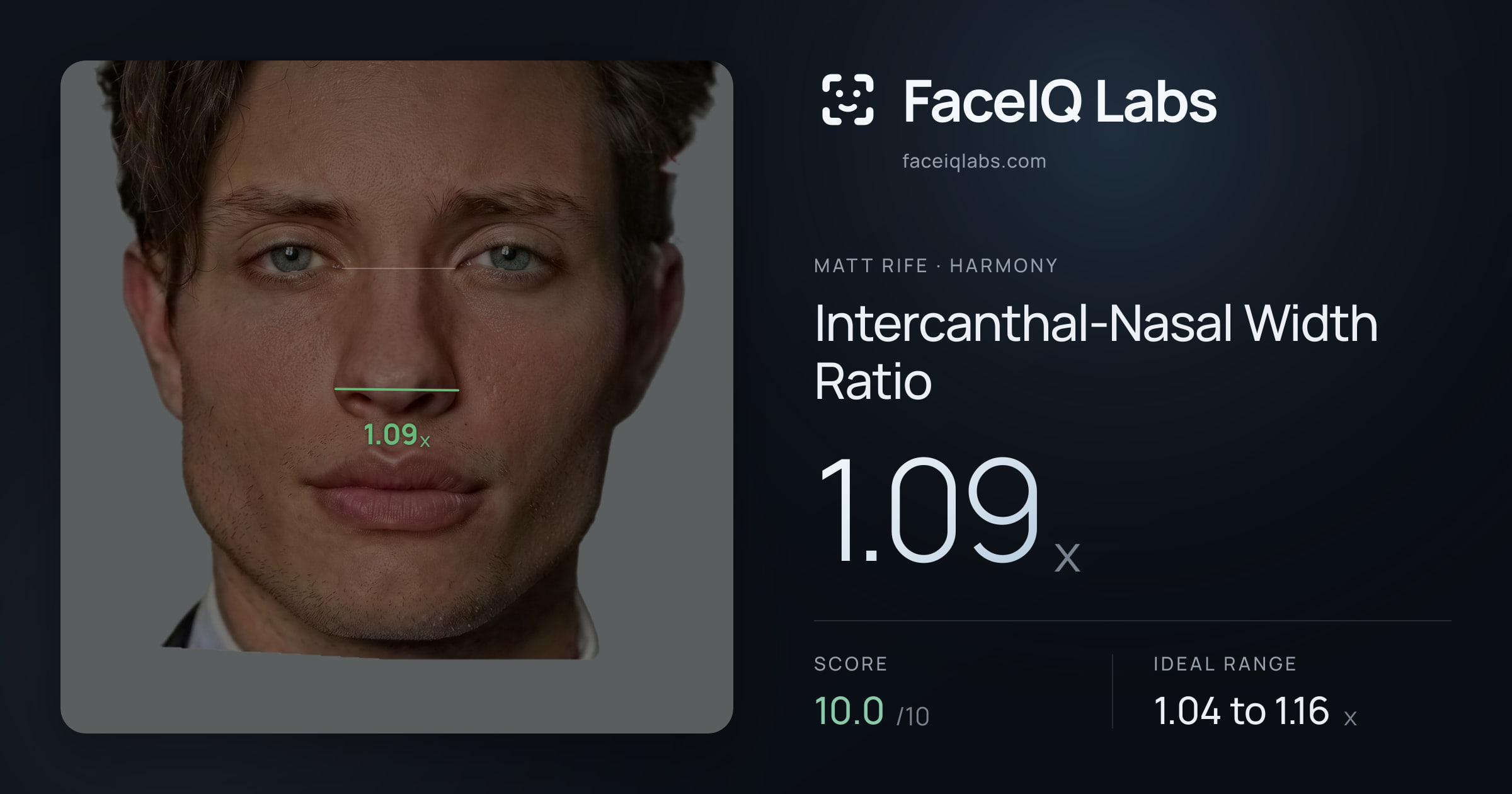 Matt Rife Intercanthal-Nasal Width Ratio: 1.09x, drawn on the photo
