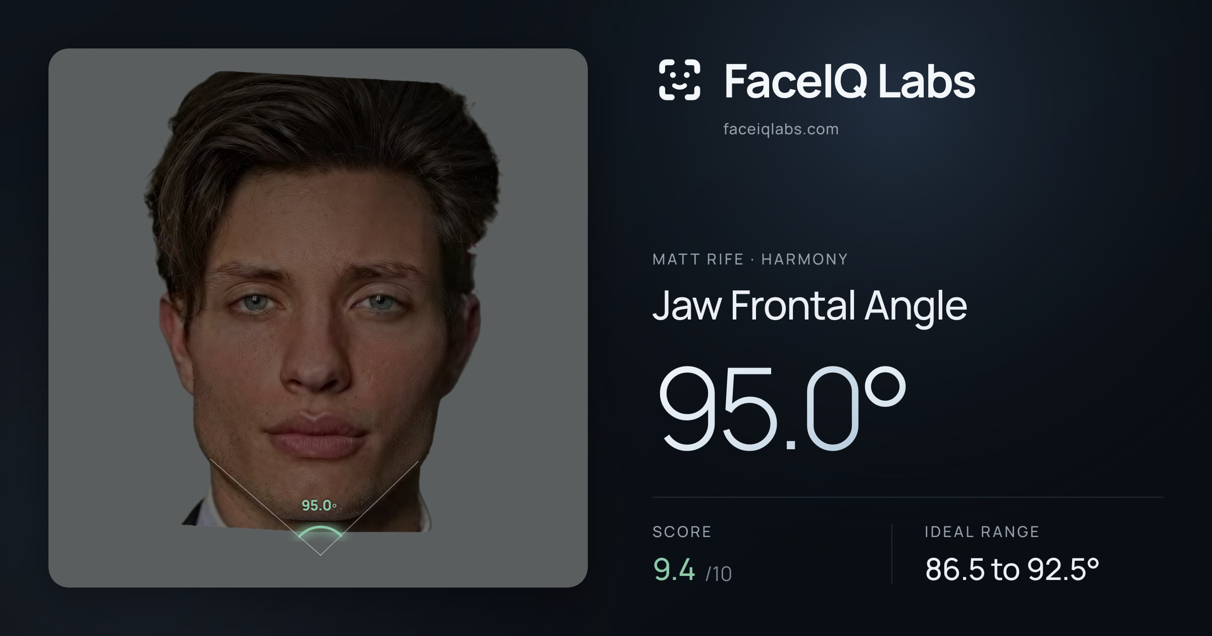 Matt Rife Jaw Frontal Angle: 95.0°, drawn on the photo