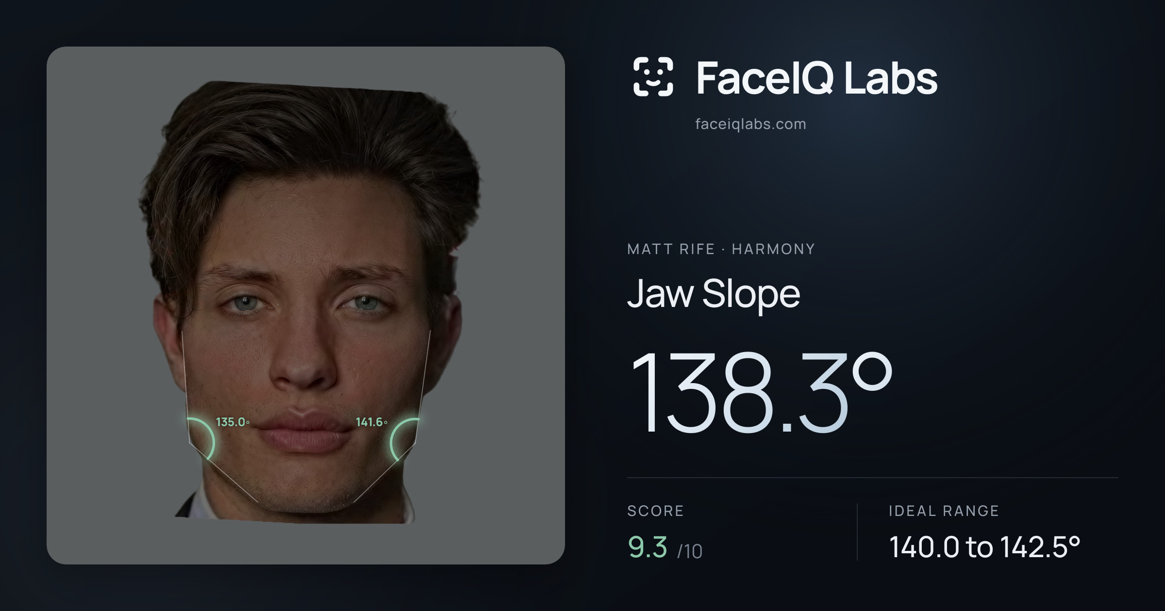 Matt Rife Jaw Slope: 138.3°, drawn on the photo