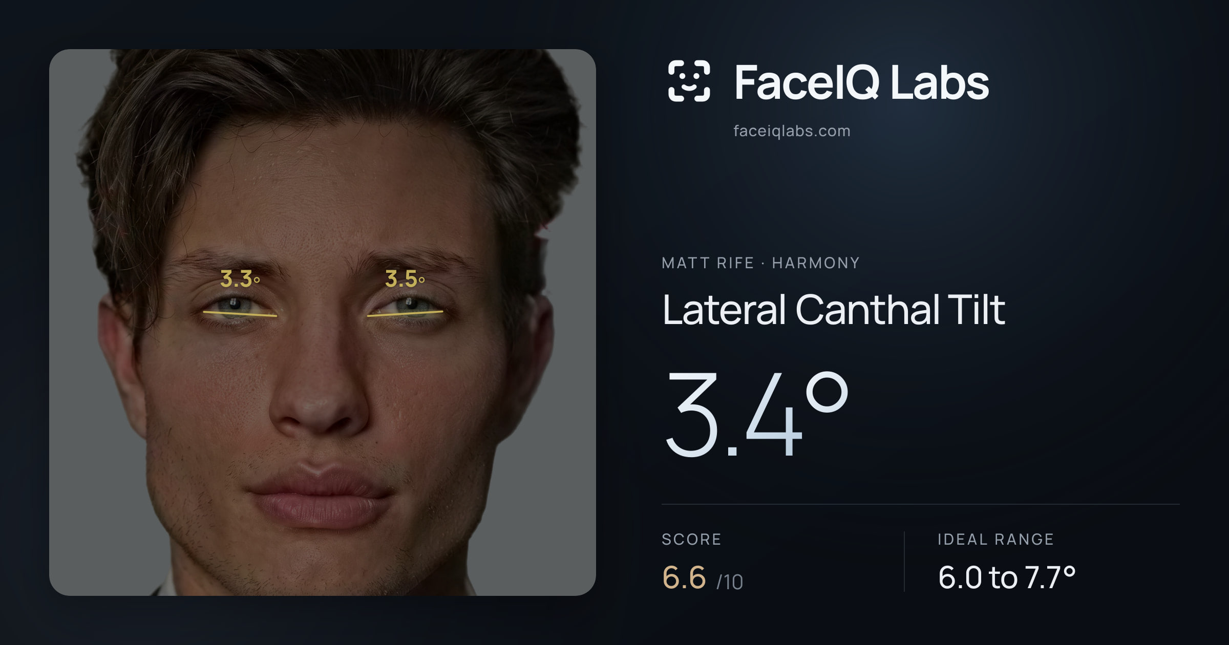 Matt Rife Lateral Canthal Tilt: 3.4°, drawn on the photo