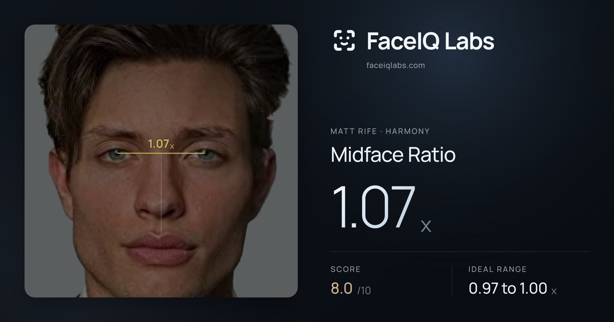 Matt Rife Midface Ratio: 1.07x, drawn on the photo