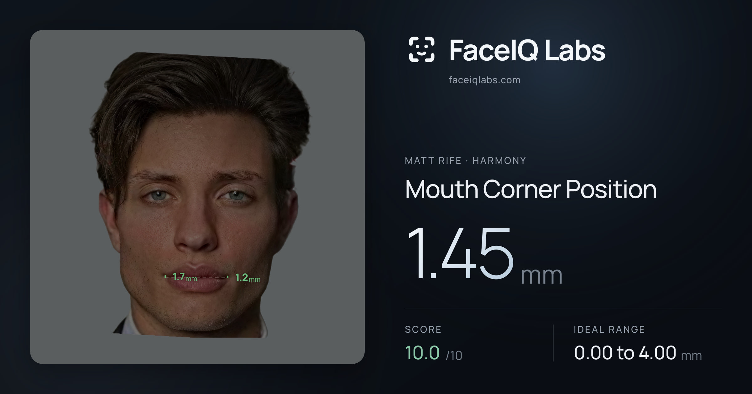 Matt Rife Mouth Corner Position: 1.45mm, drawn on the photo