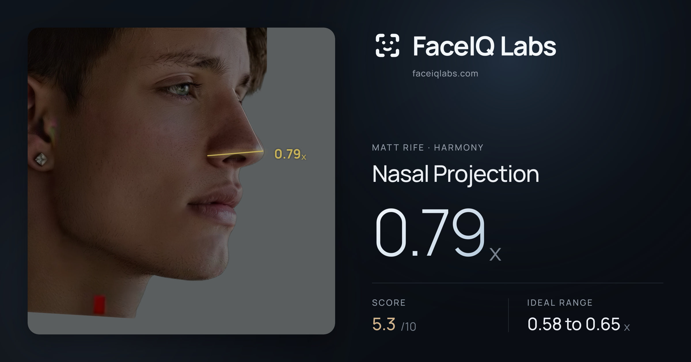 Matt Rife Nasal Projection: 0.79x, drawn on the photo
