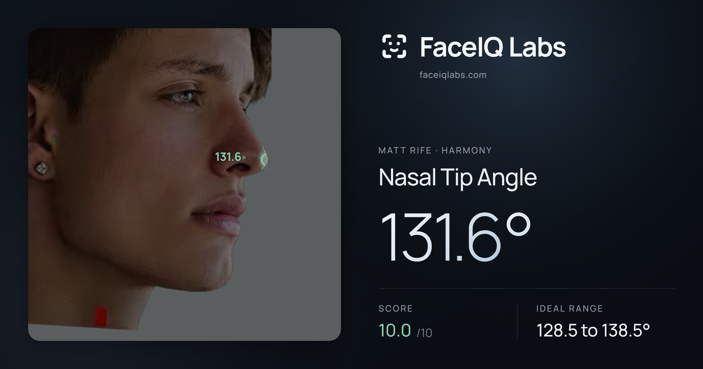 Matt Rife Nasal Tip Angle: 131.6°, drawn on the photo