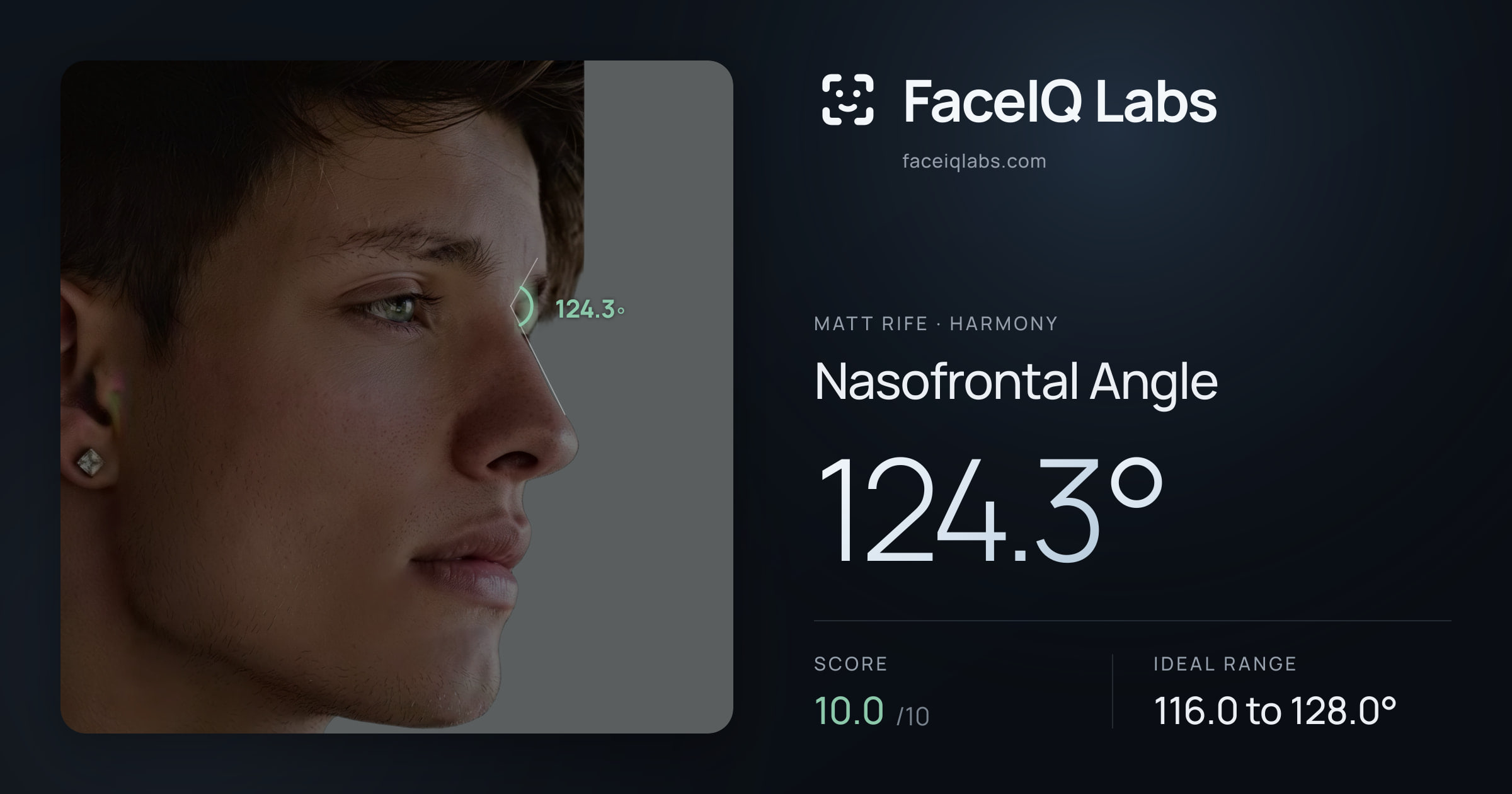 Matt Rife Nasofrontal Angle: 124.3°, drawn on the photo