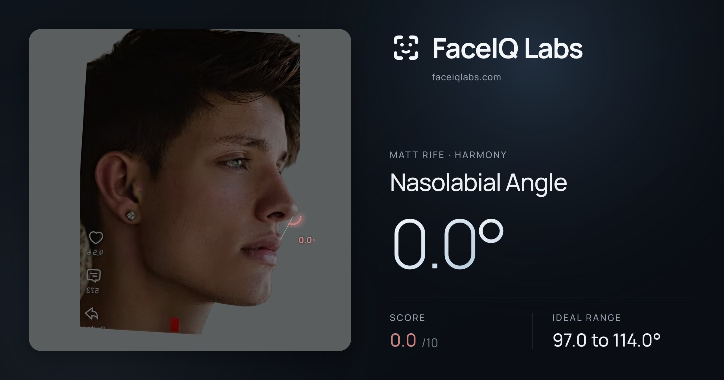 Matt Rife Nasolabial Angle: 0.0°, drawn on the photo