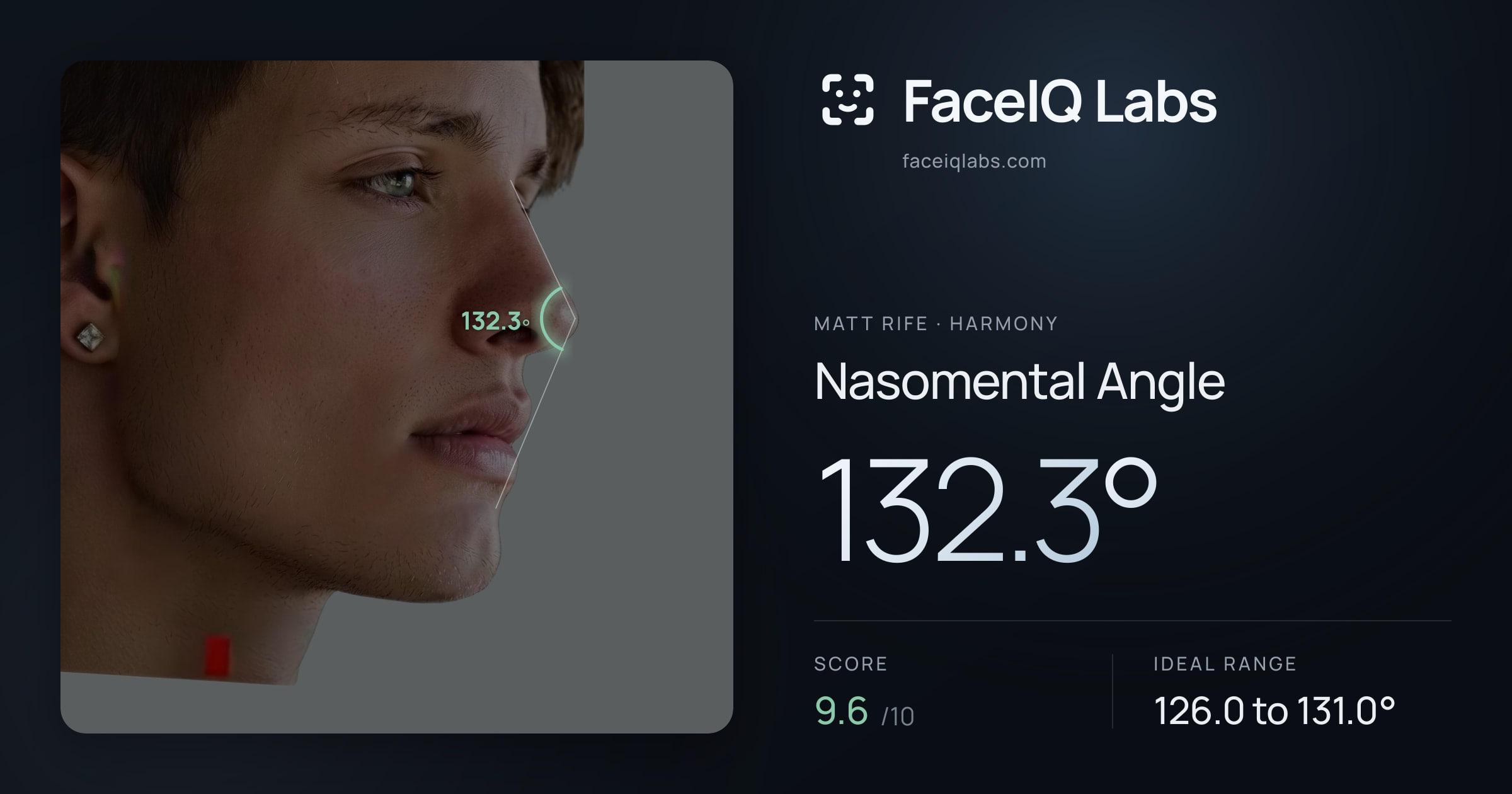 Matt Rife Nasomental Angle: 132.3°, drawn on the photo
