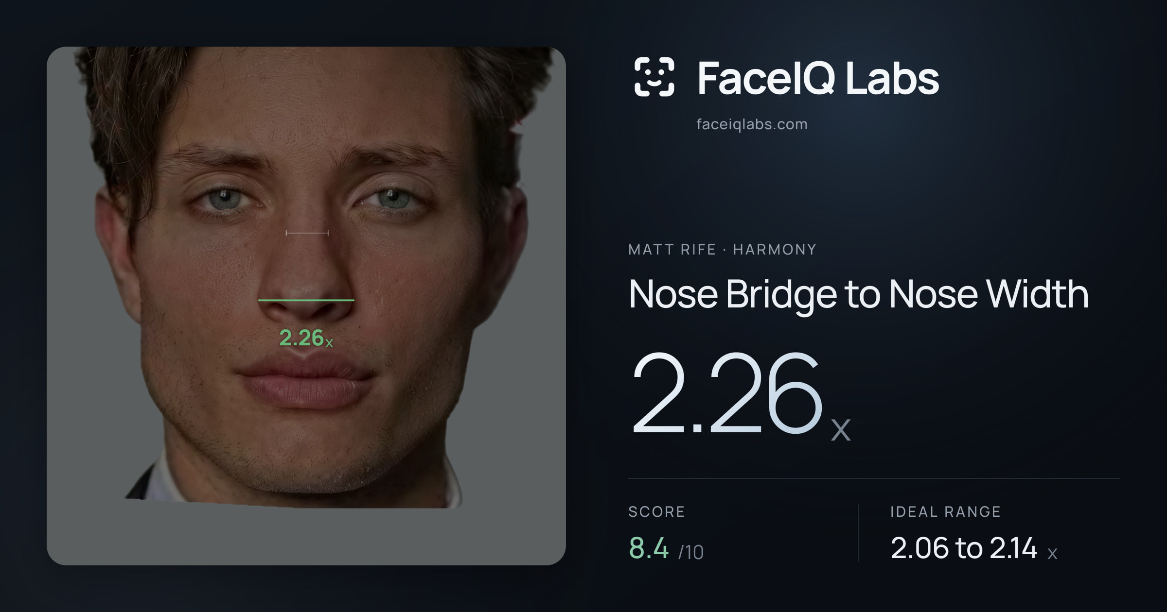 Matt Rife Nose Bridge to Nose Width: 2.26x, drawn on the photo