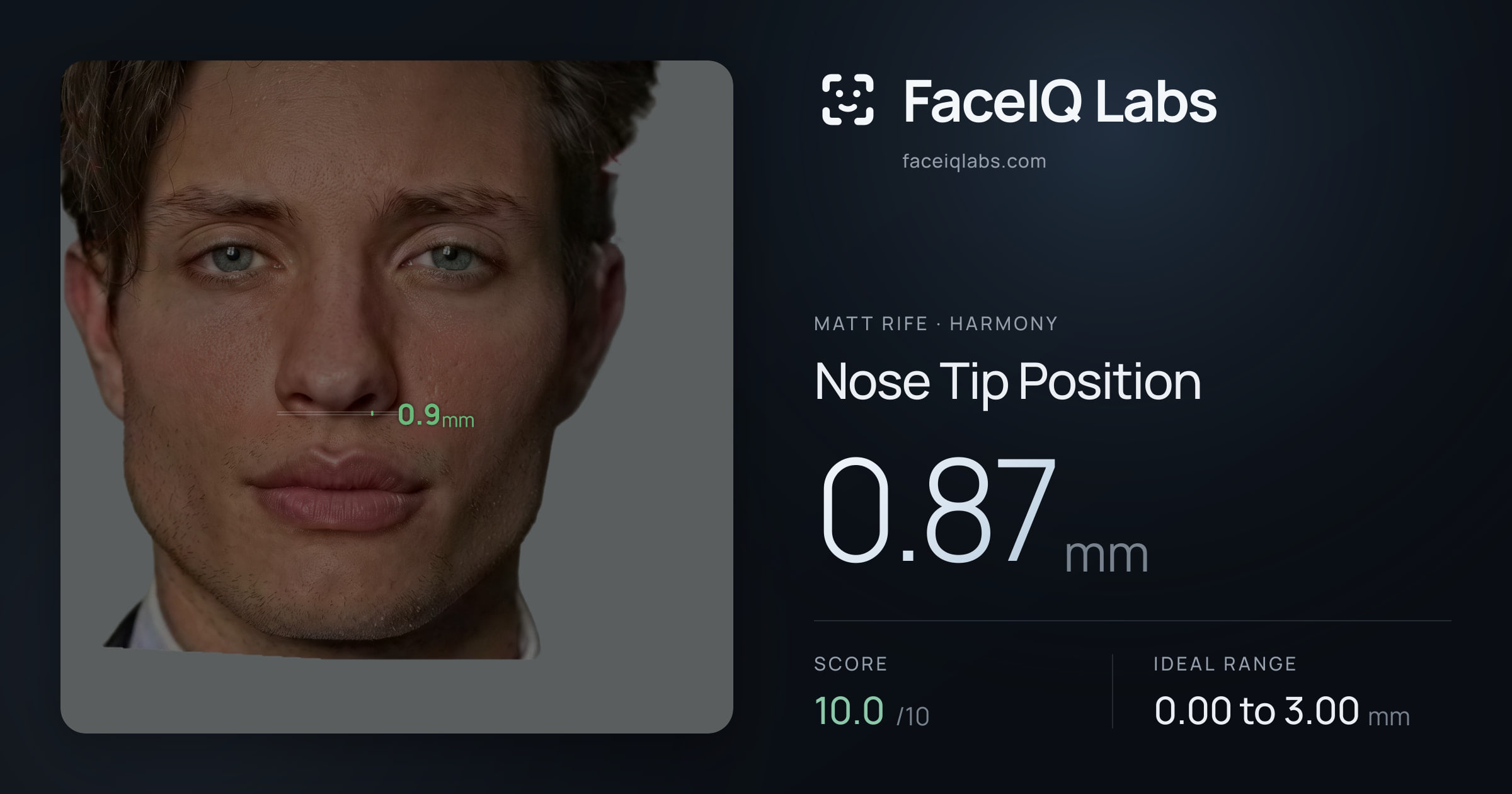 Matt Rife Nose Tip Position: 0.87mm, drawn on the photo