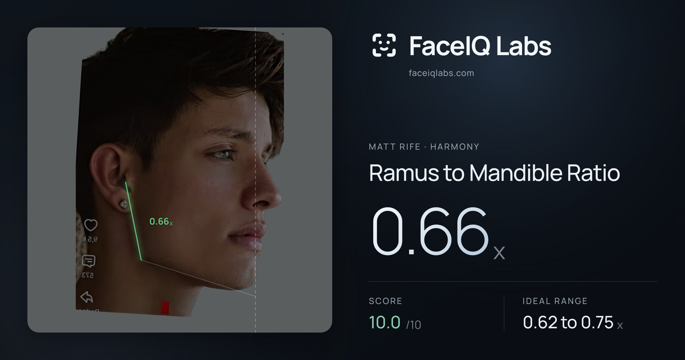 Matt Rife Ramus to Mandible Ratio: 0.66x, drawn on the photo