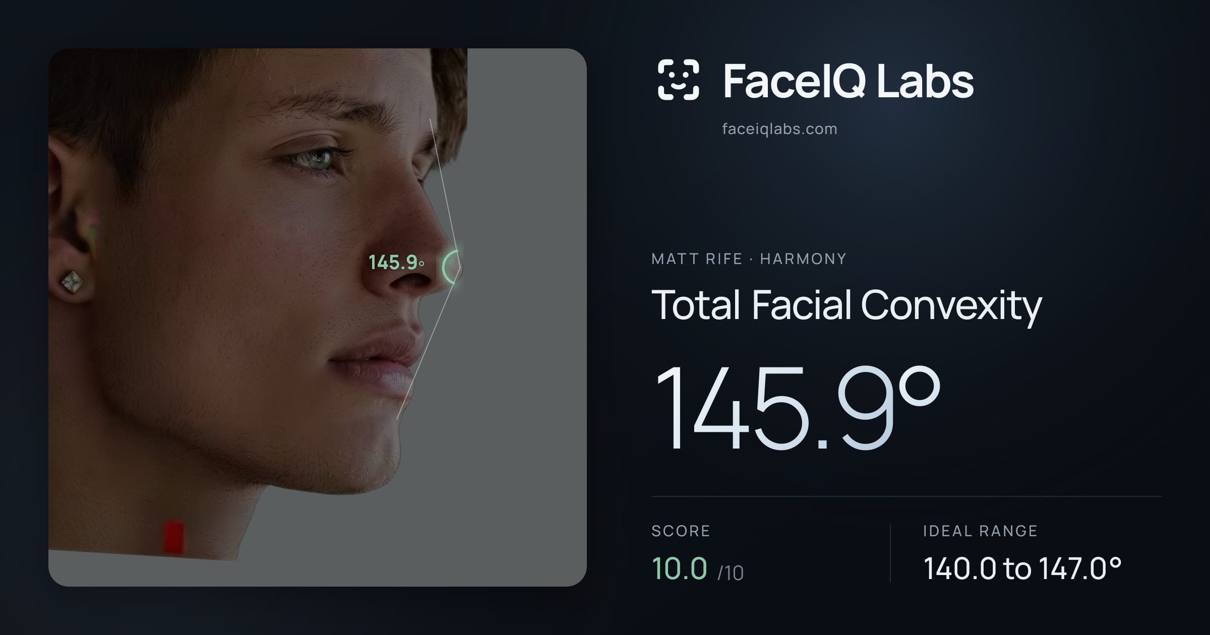 Matt Rife Total Facial Convexity: 145.9°, drawn on the photo