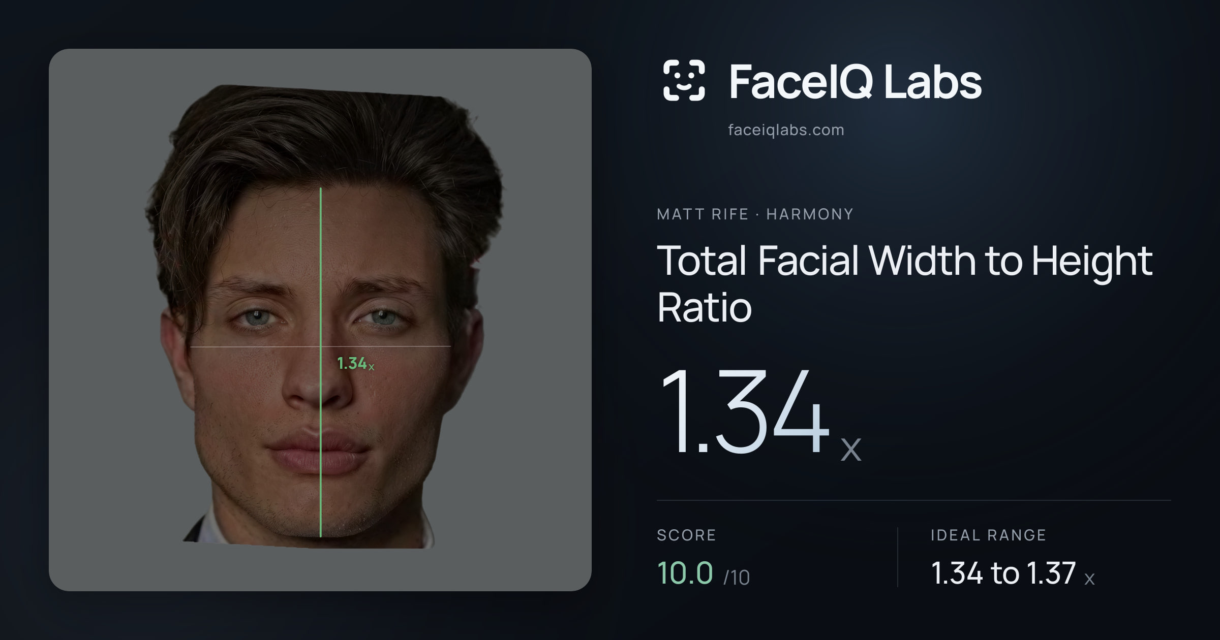 Matt Rife Total Facial Width to Height Ratio: 1.34x, drawn on the photo