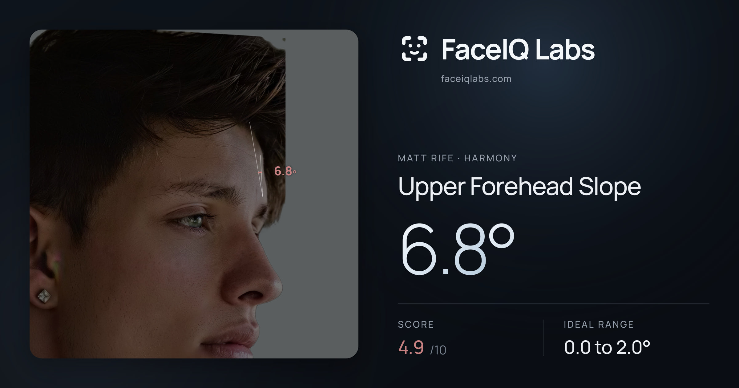 Matt Rife Upper Forehead Slope: 6.8°, drawn on the photo
