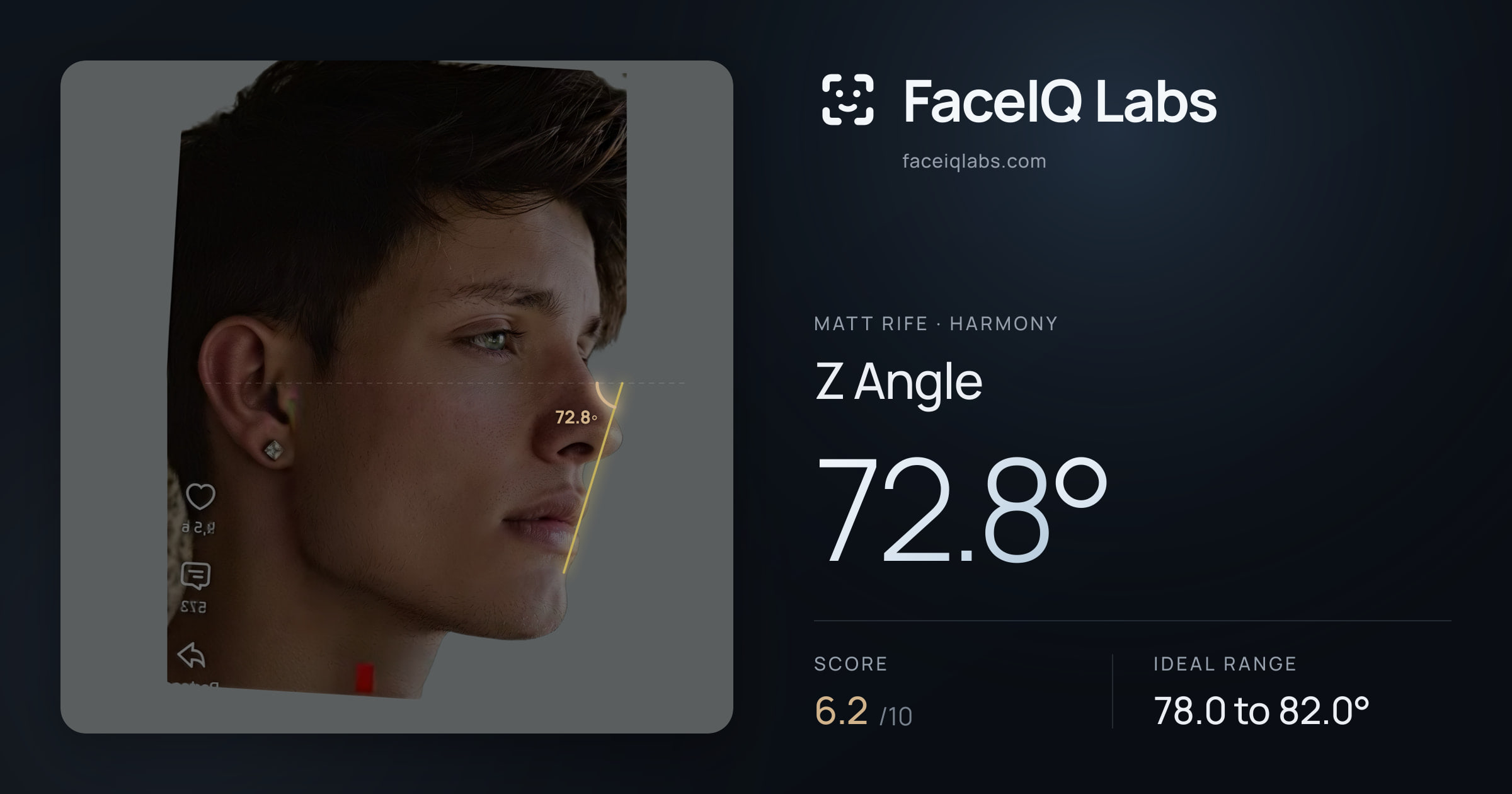 Matt Rife Z Angle: 72.8°, drawn on the photo
