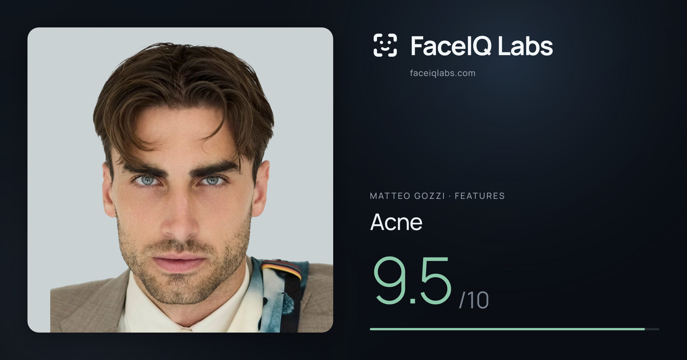 Matteo Gozzi Acne: 9.5/10, drawn on the photo