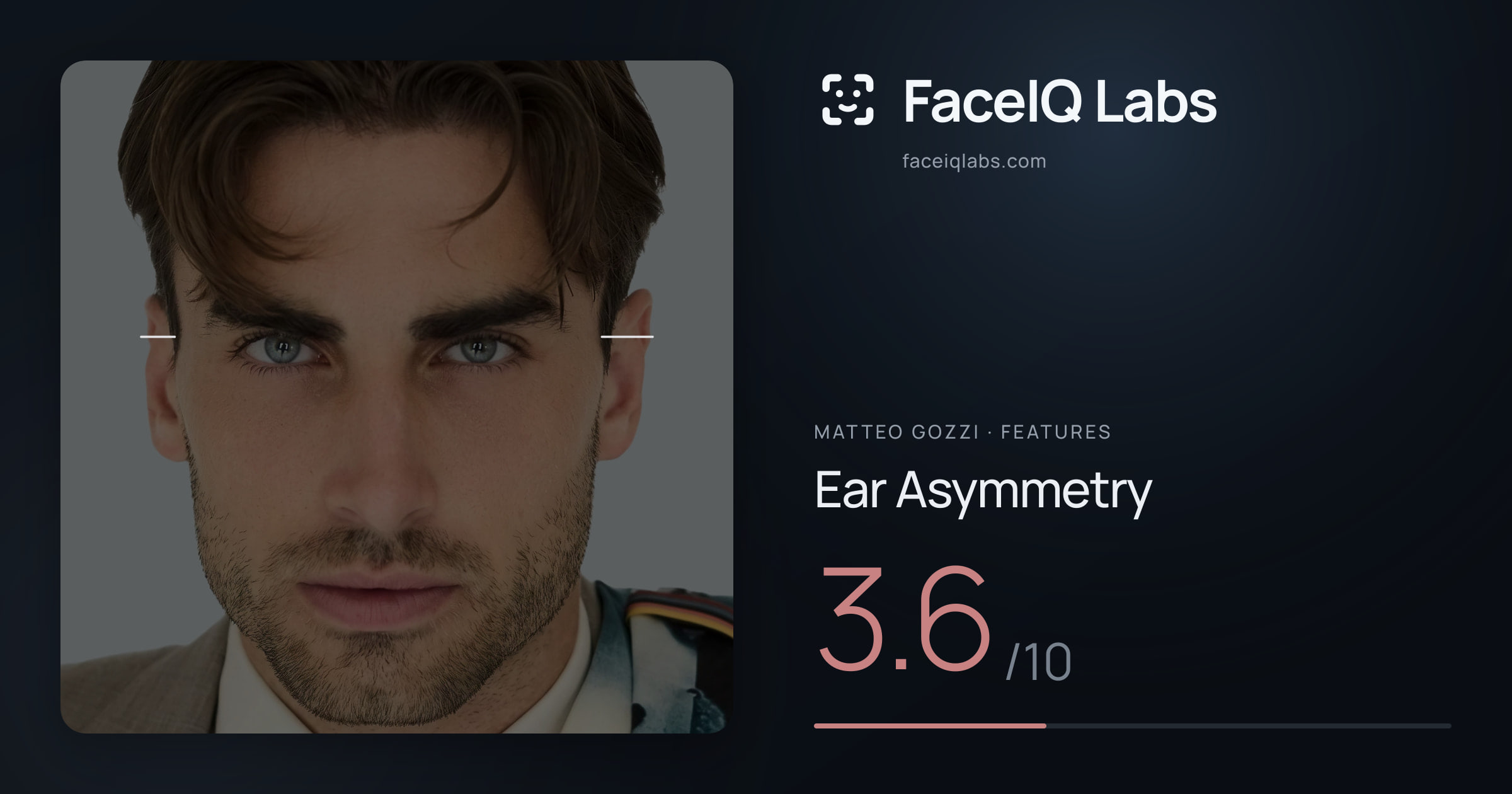 Matteo Gozzi Ear Asymmetry: 3.6/10, drawn on the photo