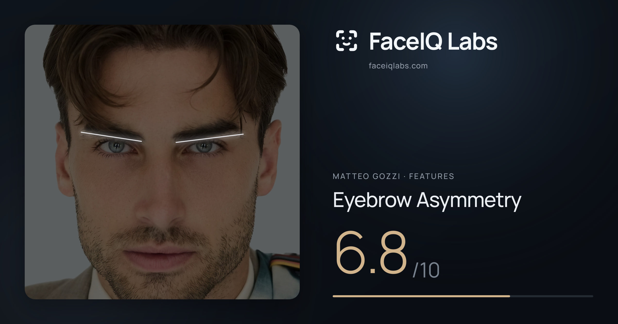 Matteo Gozzi Eyebrow Asymmetry: 6.8/10, drawn on the photo