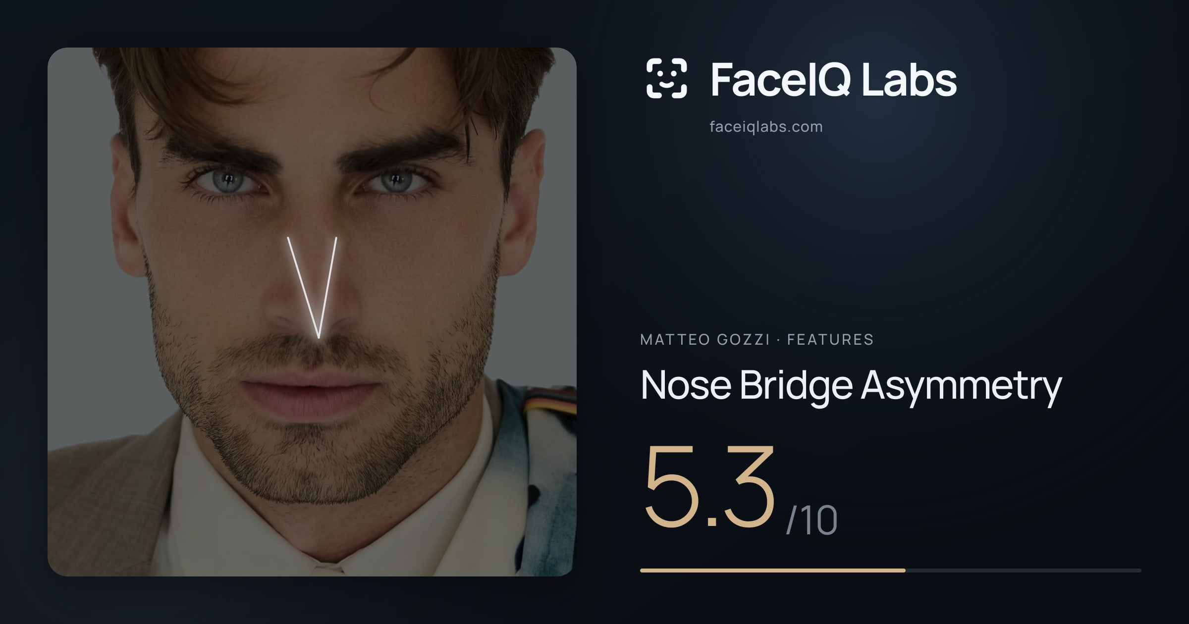 Matteo Gozzi Nose Bridge Asymmetry: 5.3/10, drawn on the photo