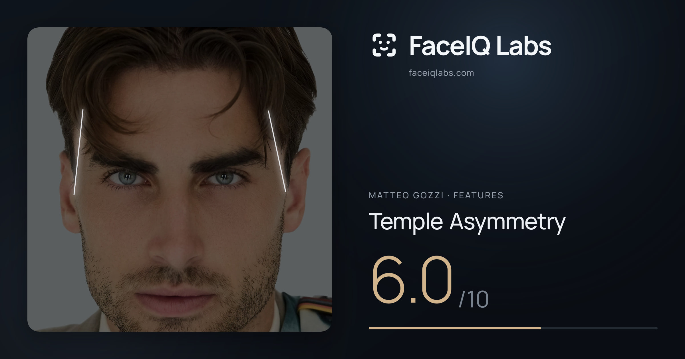 Matteo Gozzi Temple Asymmetry: 6.0/10, drawn on the photo
