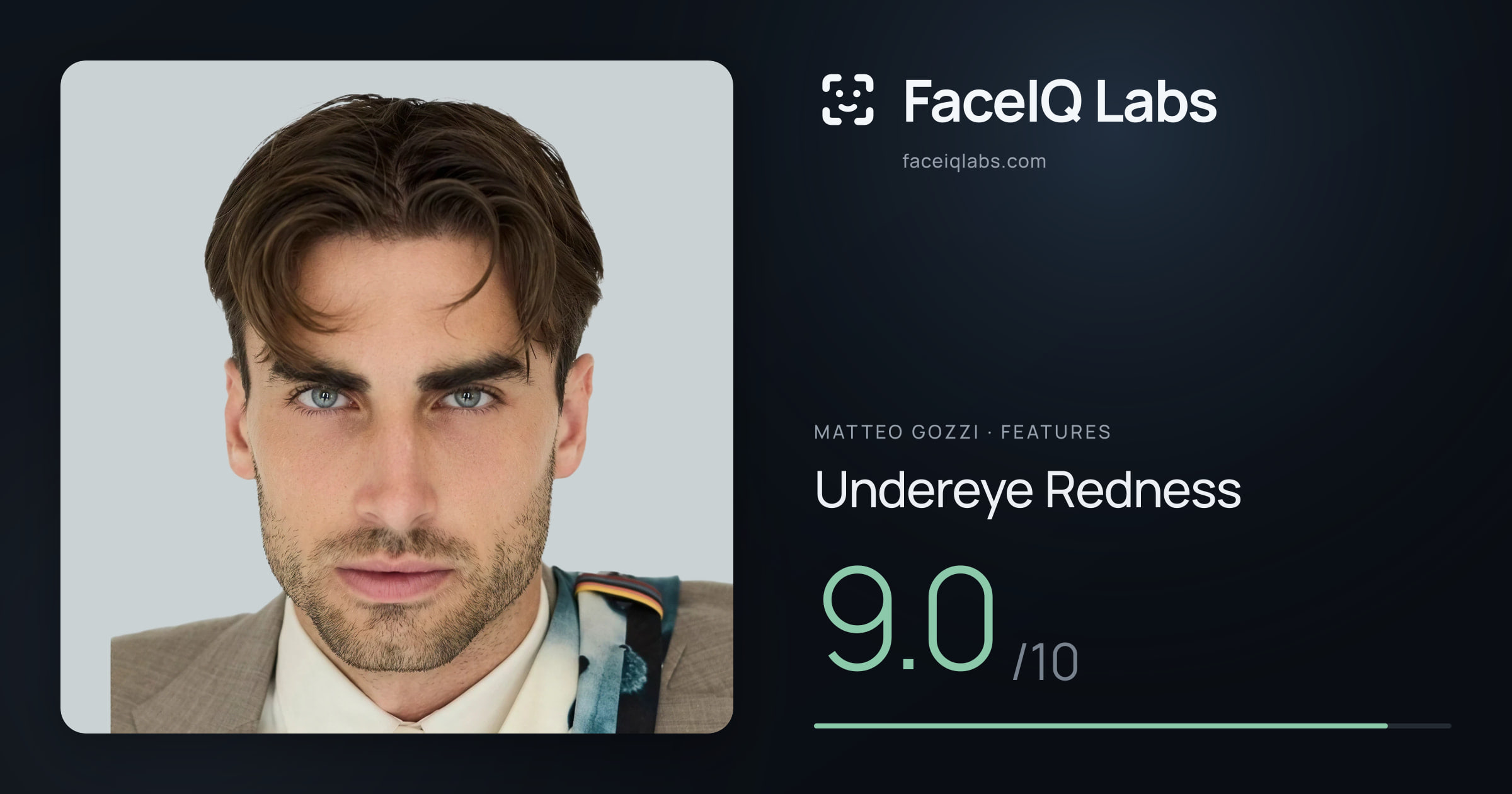 Matteo Gozzi Undereye Redness: 9.0/10, drawn on the photo