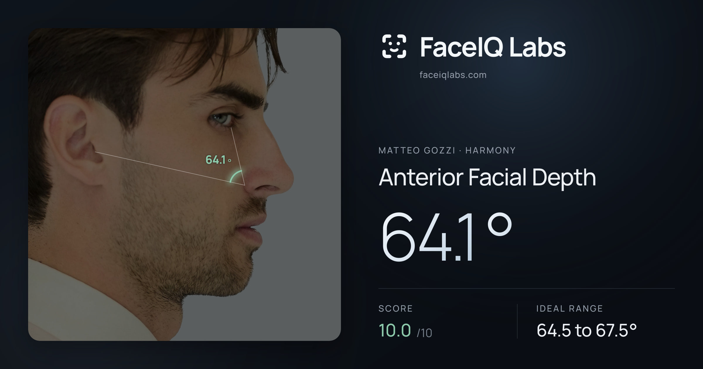Matteo Gozzi Anterior Facial Depth: 64.1°, drawn on the photo