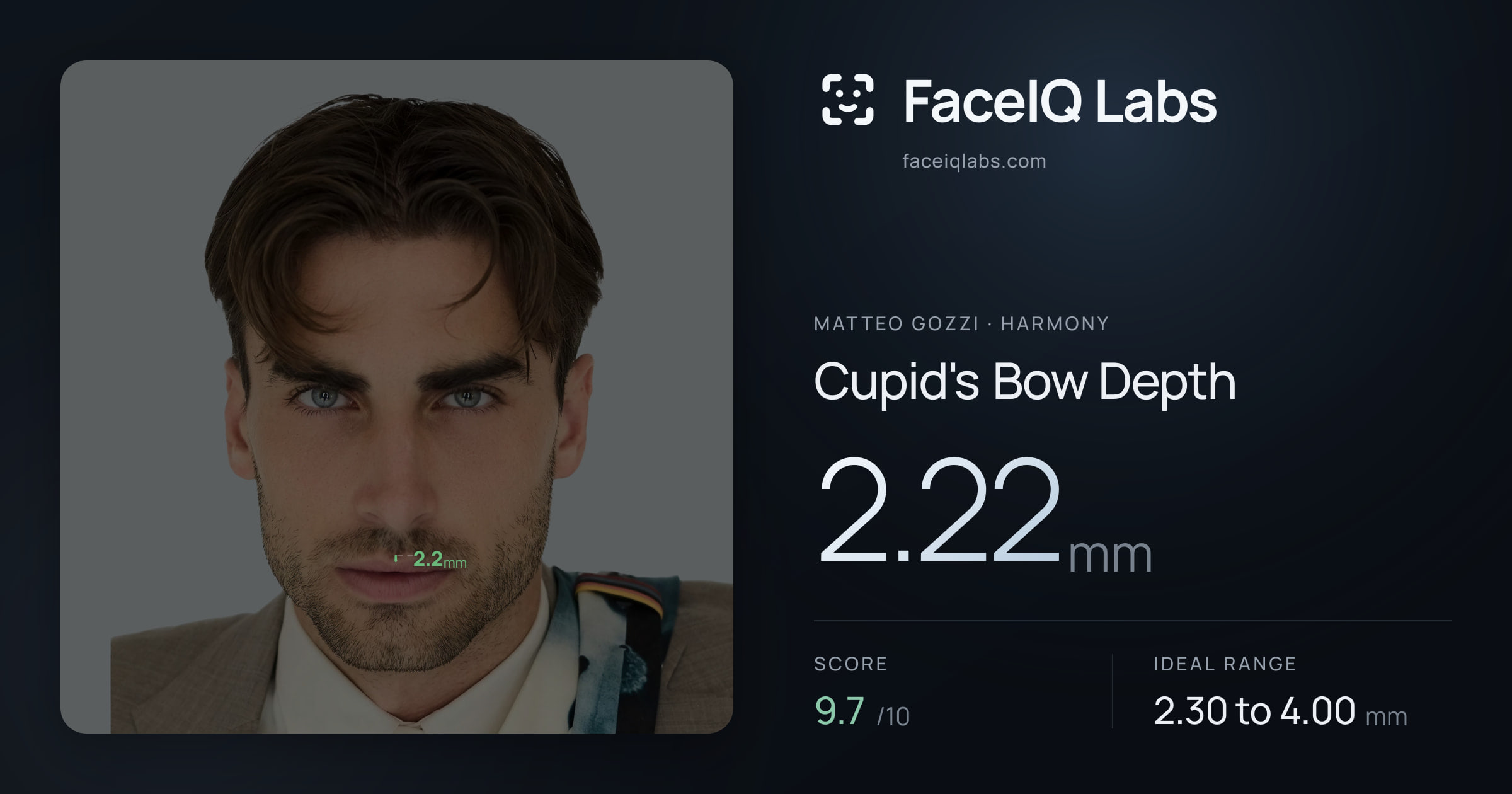 Matteo Gozzi Cupid's Bow Depth: 2.22mm, drawn on the photo