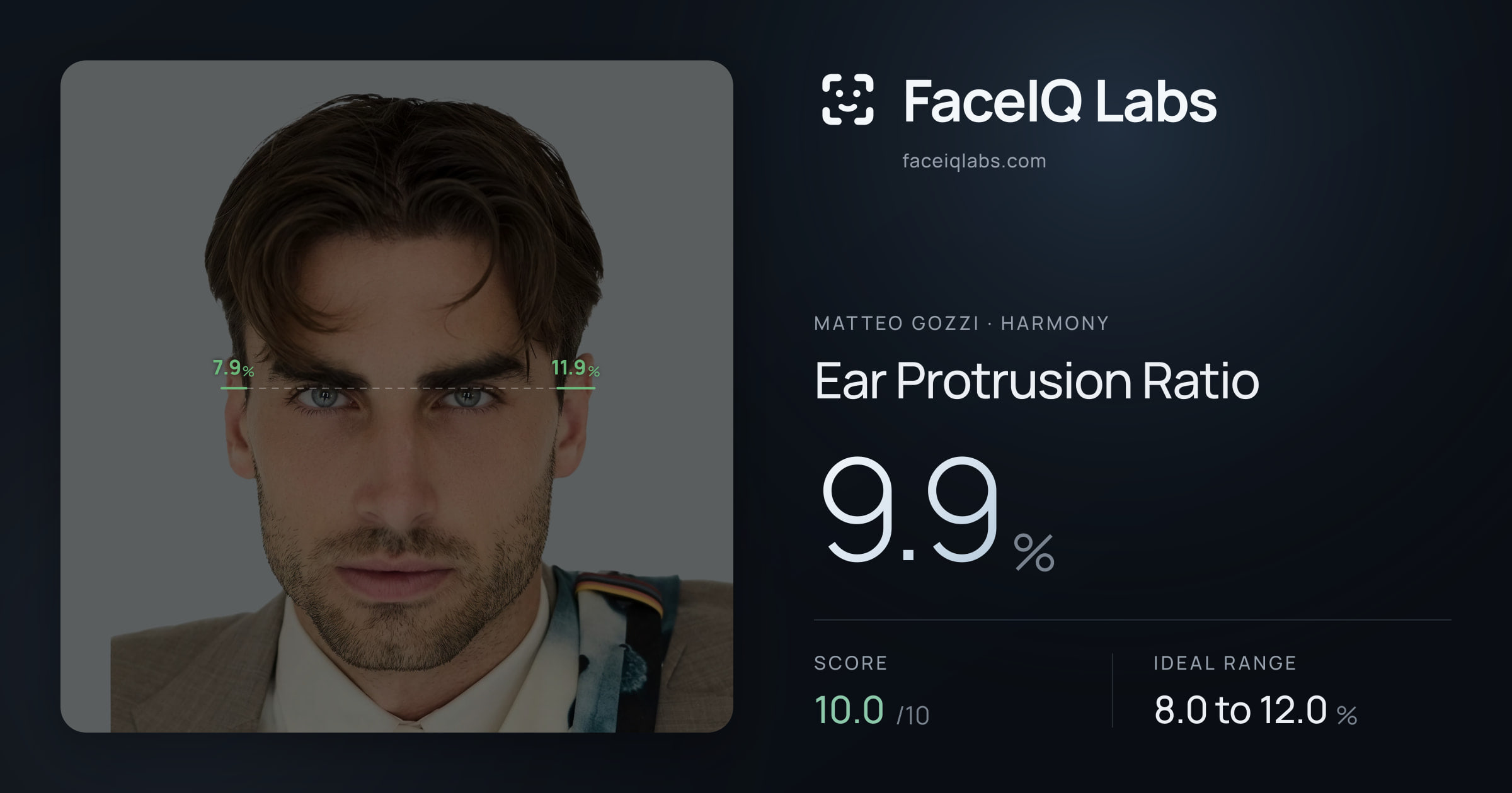 Matteo Gozzi Ear Protrusion Ratio: 9.9%, drawn on the photo