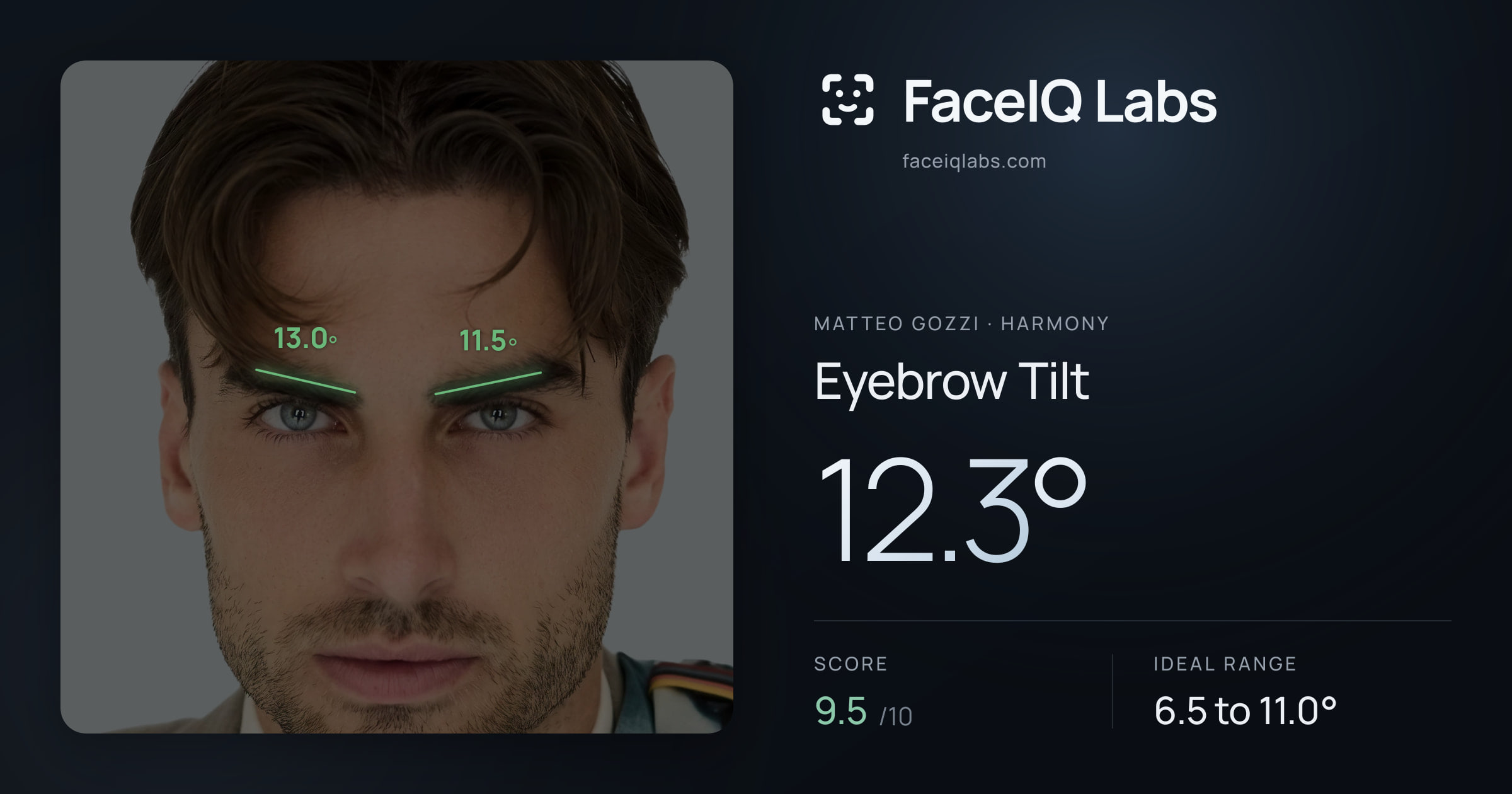 Matteo Gozzi Eyebrow Tilt: 12.3°, drawn on the photo