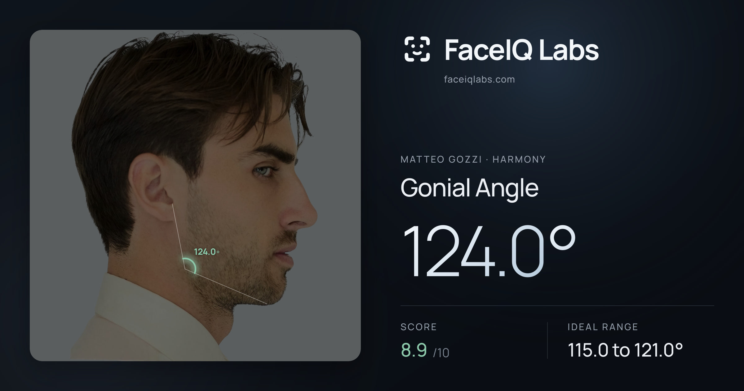 Matteo Gozzi Gonial Angle: 124.0°, drawn on the photo
