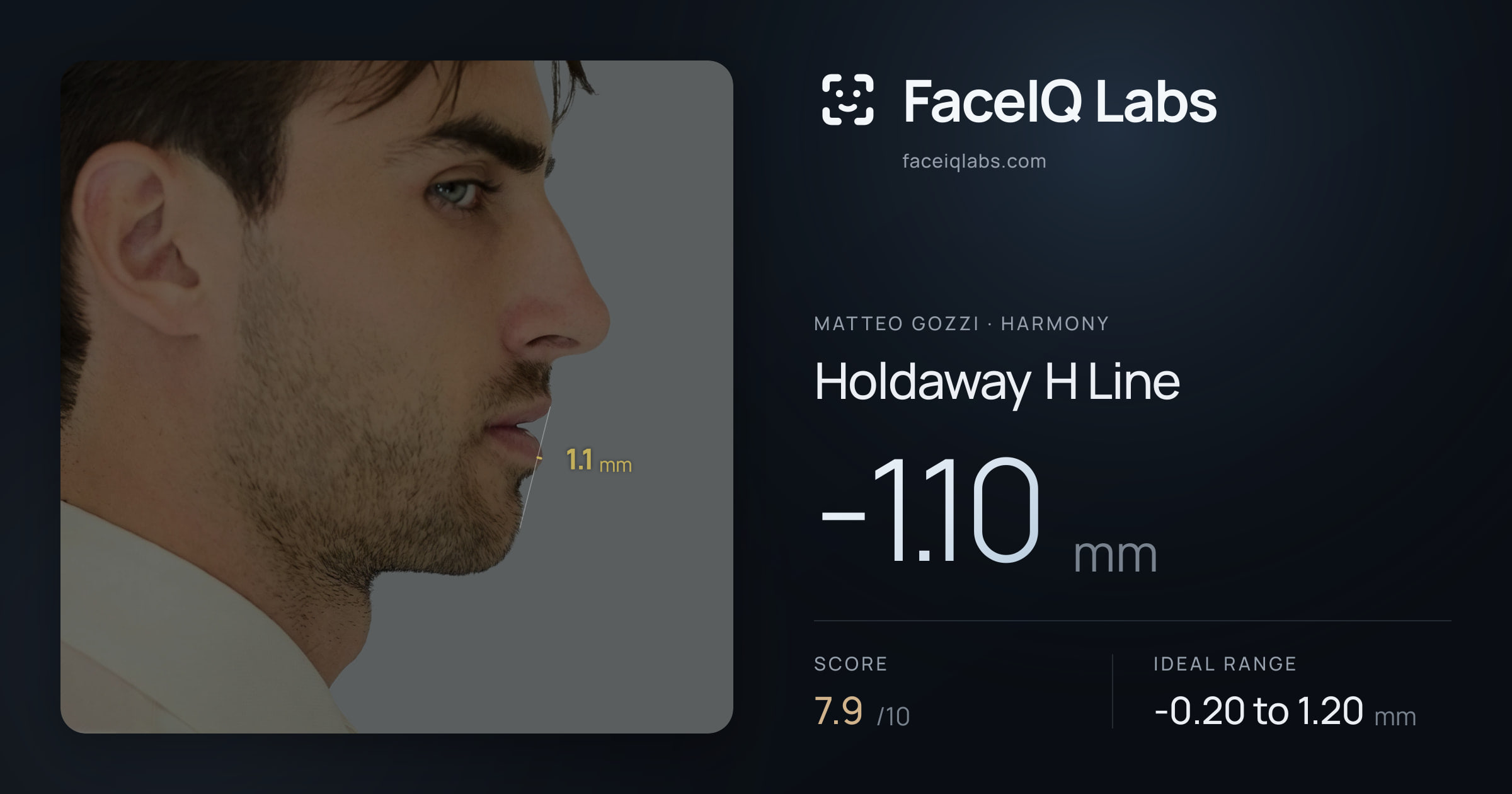 Matteo Gozzi Holdaway H Line: -1.10mm, drawn on the photo