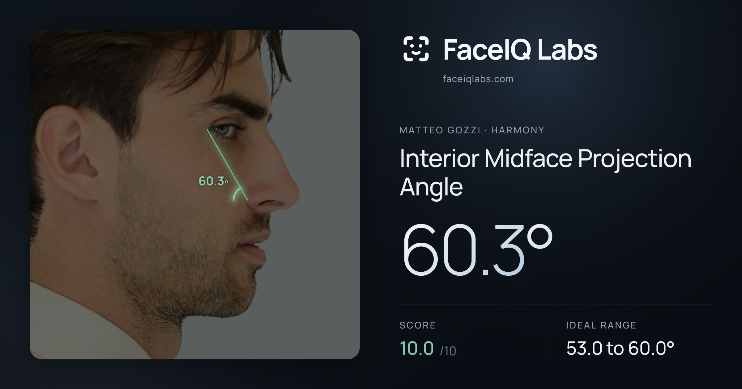 Matteo Gozzi Interior Midface Projection Angle: 60.3°, drawn on the photo