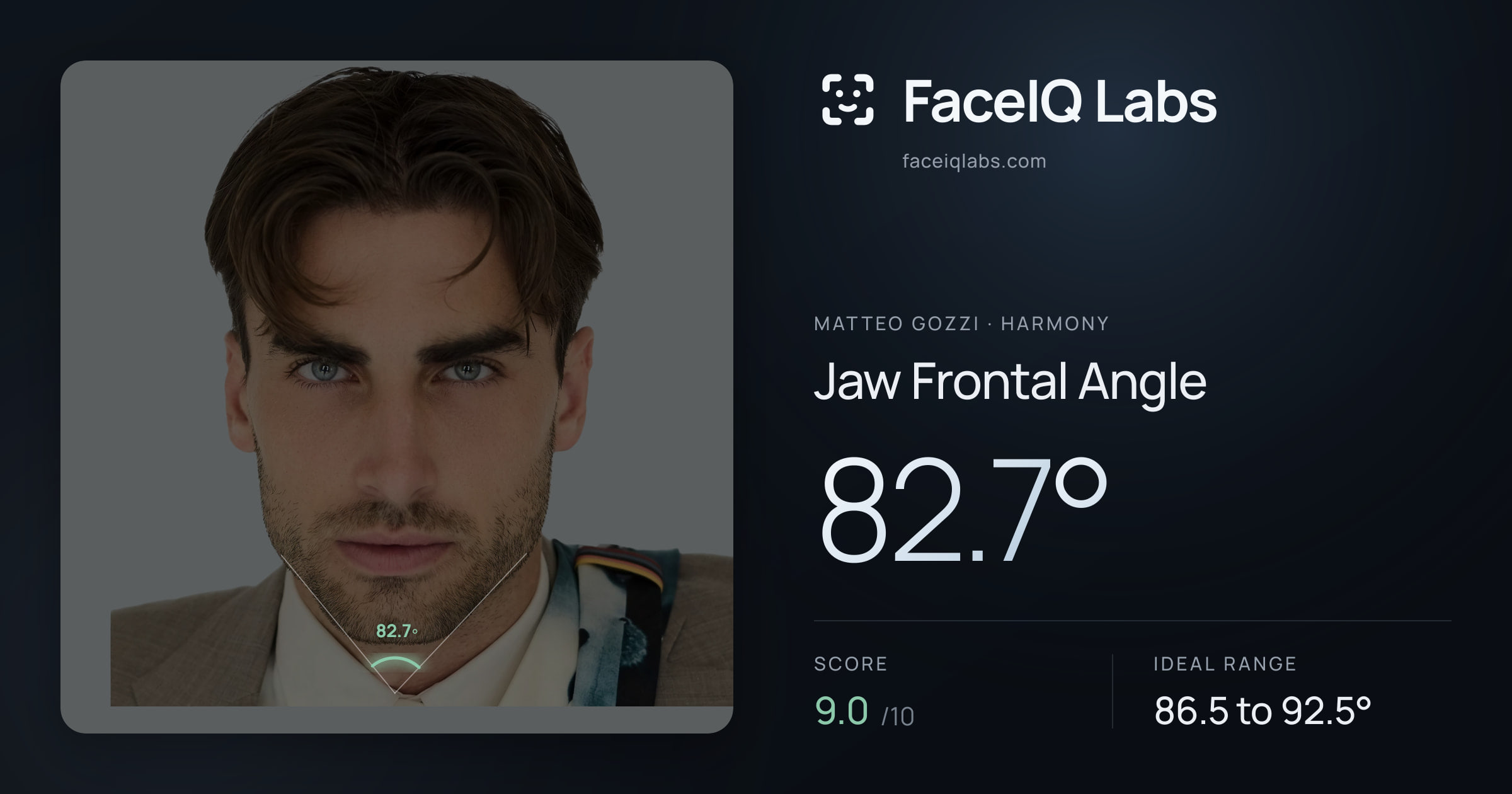 Matteo Gozzi Jaw Frontal Angle: 82.7°, drawn on the photo