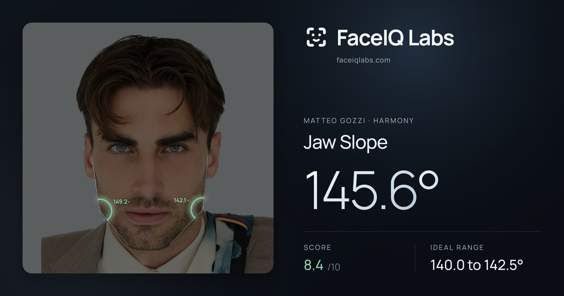 Matteo Gozzi Jaw Slope: 145.6°, drawn on the photo