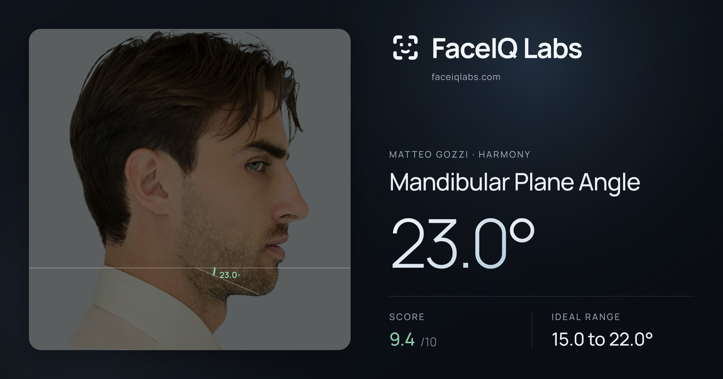 Matteo Gozzi Mandibular Plane Angle: 23.0°, drawn on the photo