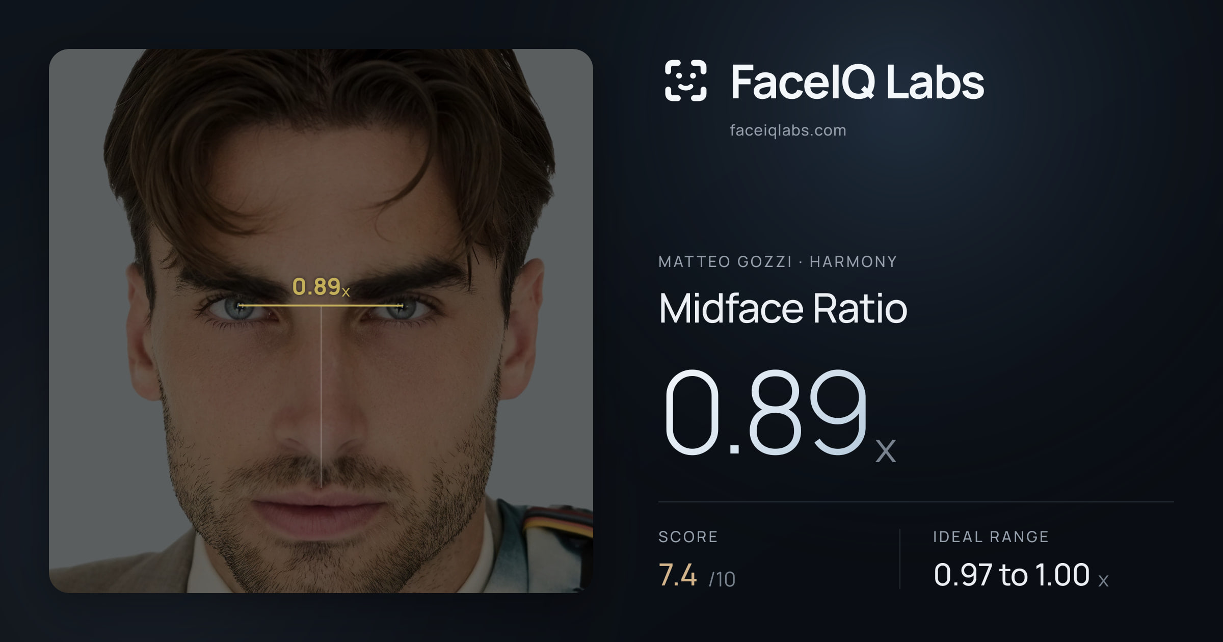 Matteo Gozzi Midface Ratio: 0.89x, drawn on the photo