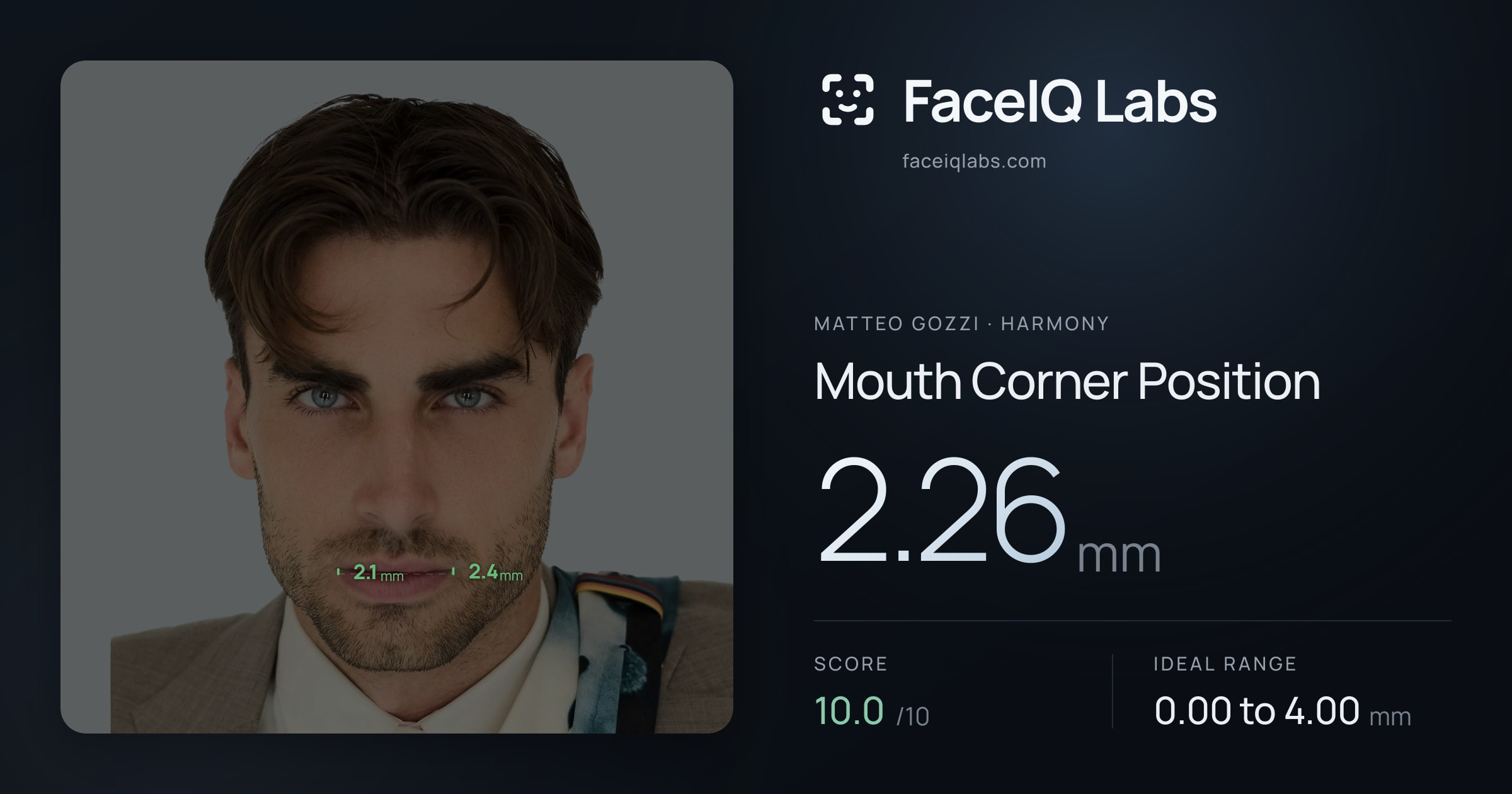 Matteo Gozzi Mouth Corner Position: 2.26mm, drawn on the photo
