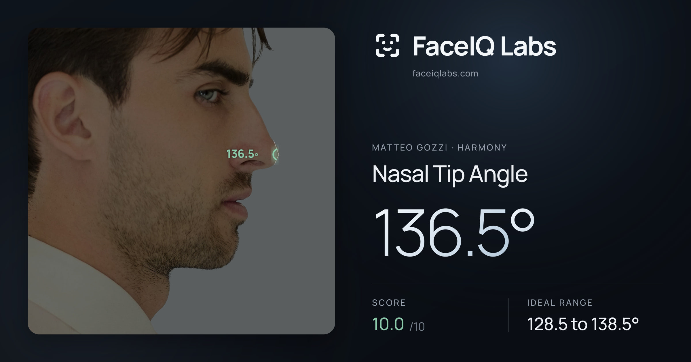 Matteo Gozzi Nasal Tip Angle: 136.5°, drawn on the photo