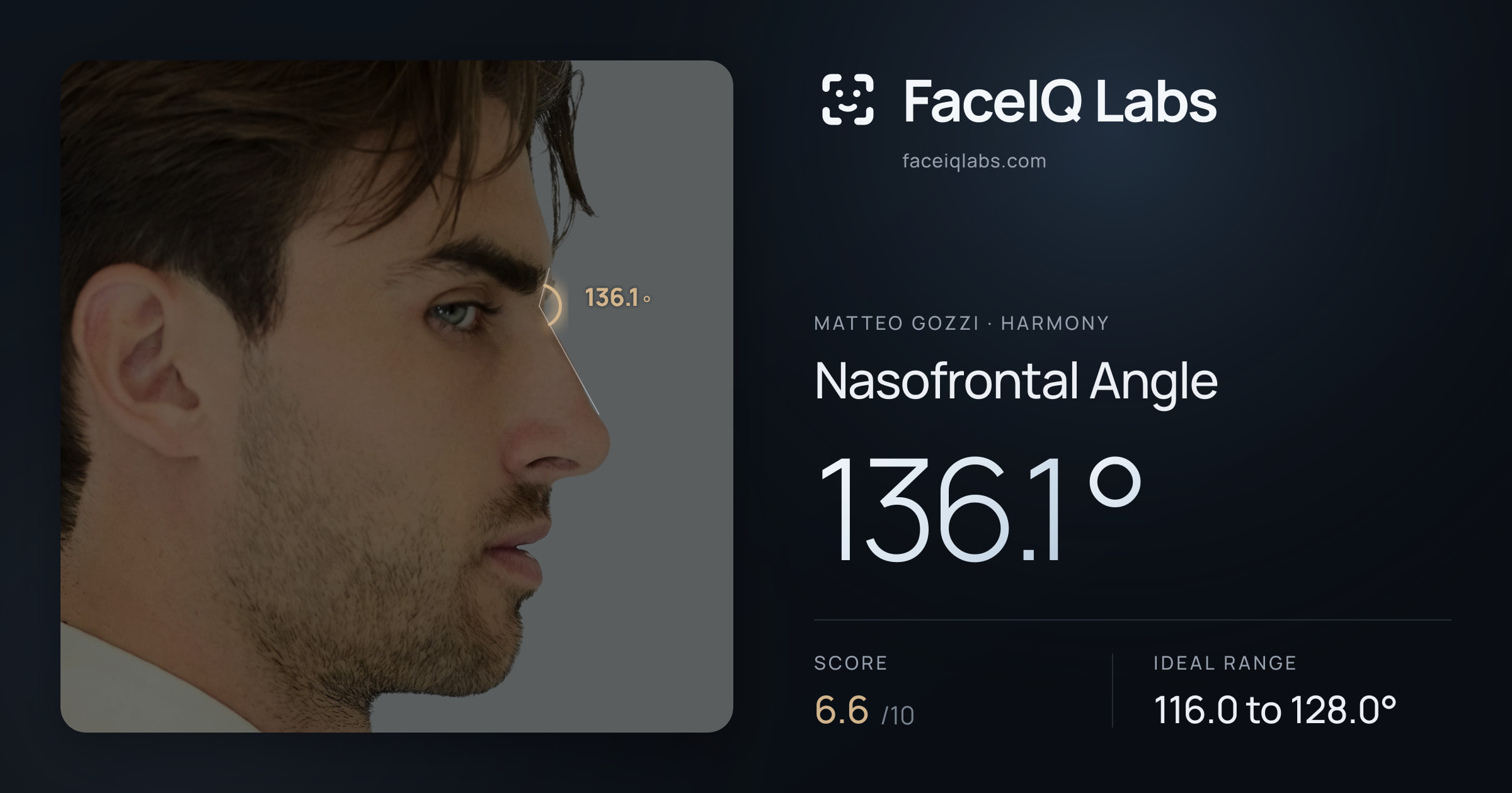 Matteo Gozzi Nasofrontal Angle: 136.1°, drawn on the photo